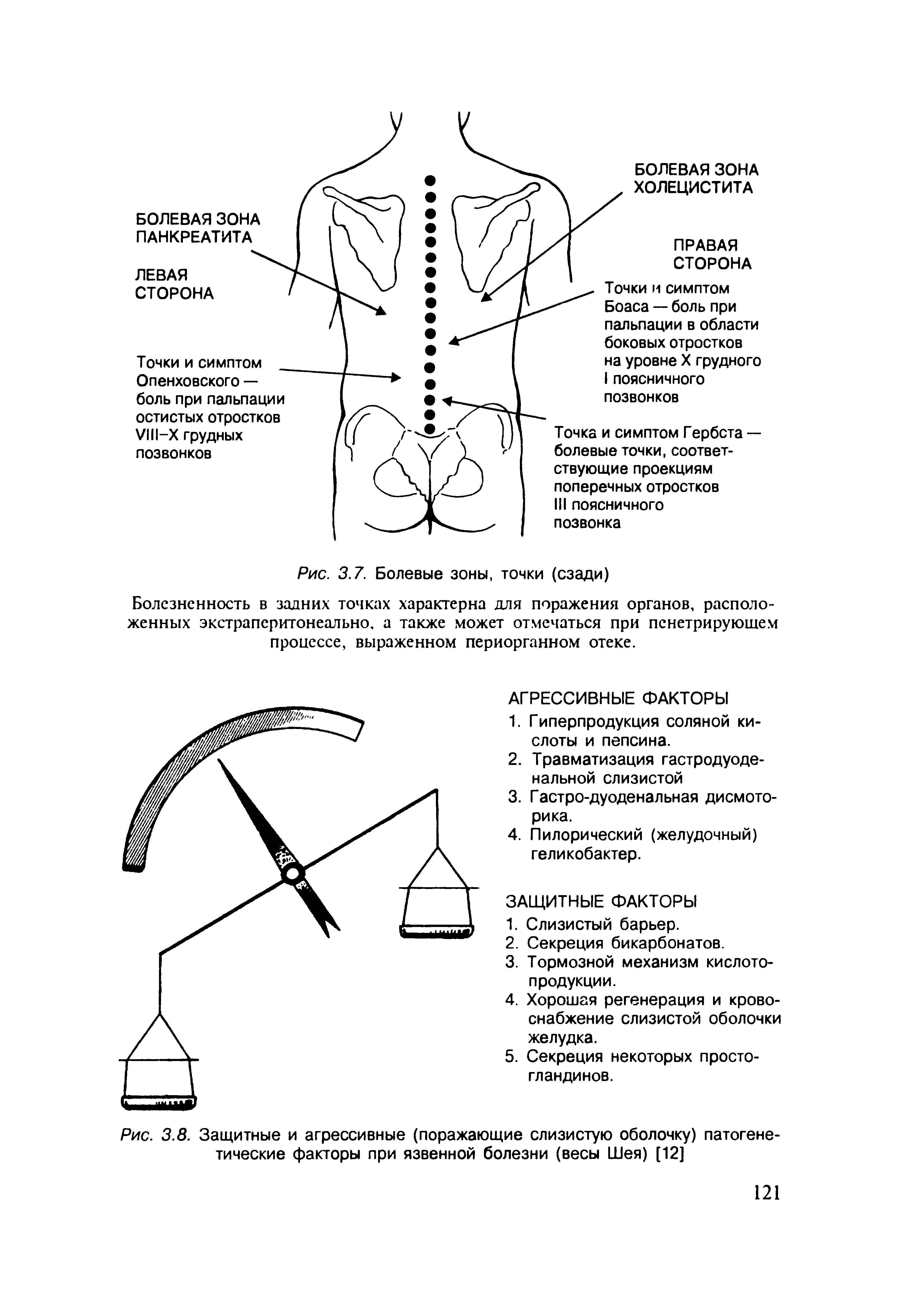 Рис. 3.8. Защитные и агрессивные (поражающие слизистую оболочку) патогенетические факторы при язвенной болезни (весы Шея) [12]...