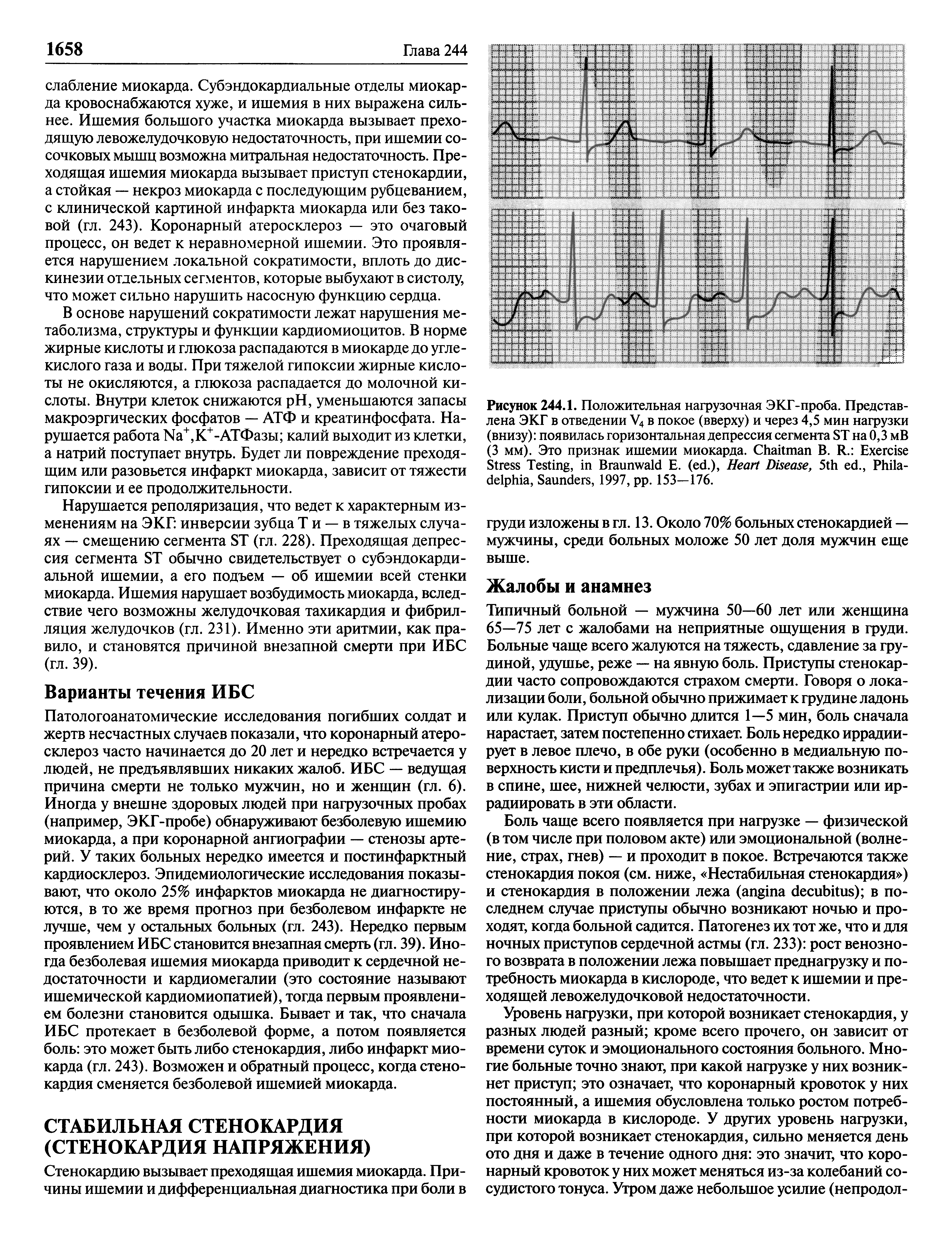 Рисунок 244.1. Положительная нагрузочная ЭКГ-проба. Представлена ЭКГ в отведении V4 в покое (вверху) и через 4,5 мин нагрузки (внизу) появилась горизонтальная депрессия сегмента ST на 0,3 мВ (3 мм). Это признак ишемии миокарда. C В. R. E S T , B E. ( .), H D , 5 ., P , S , 1997, . 153—176.