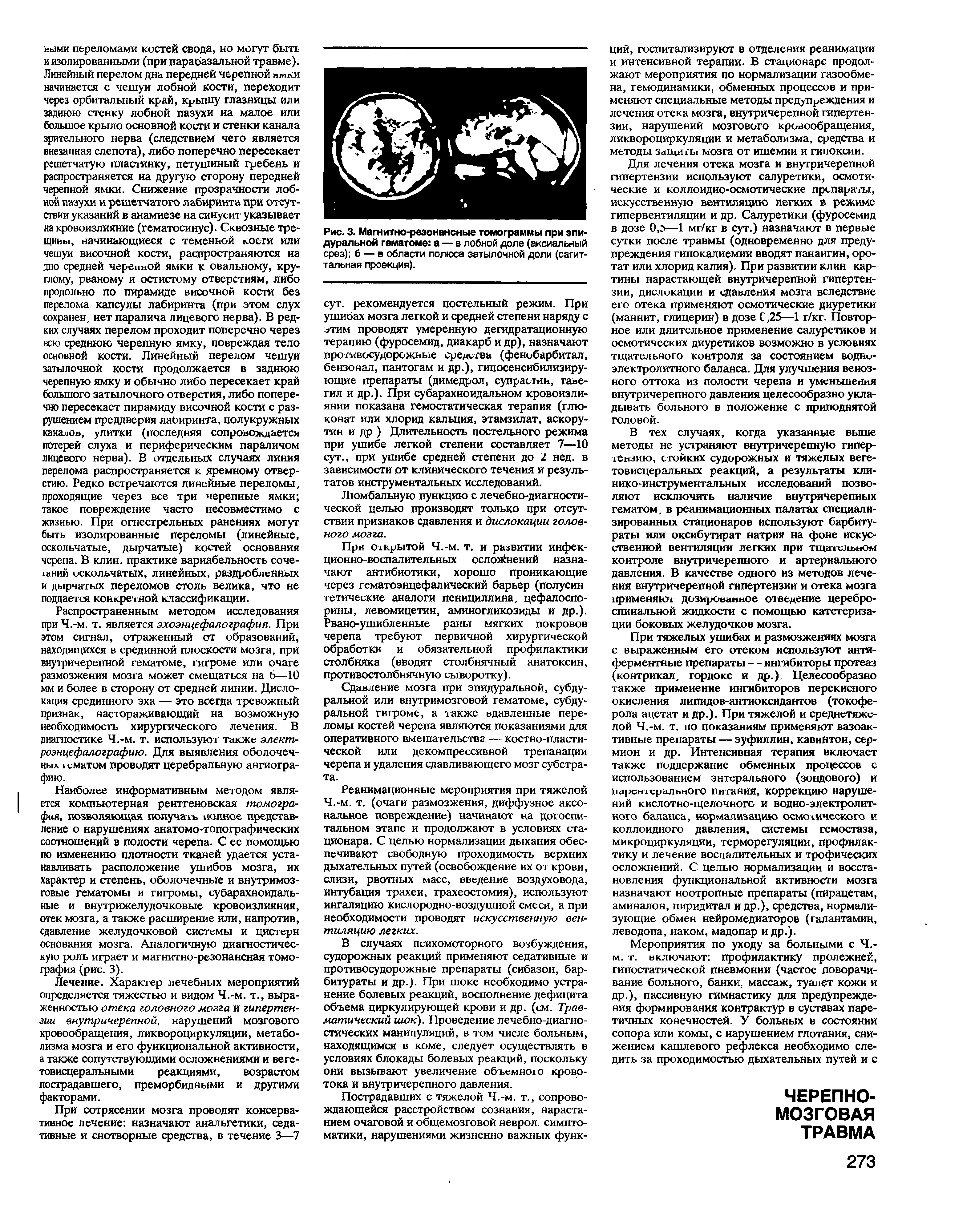 Рис. 3. Магнитно-резонансные томограммы при эпидуральной гематоме а — в лобной доле (аксиальный срез) б — в области полюса затылочной доли (сагиттальная проекция).