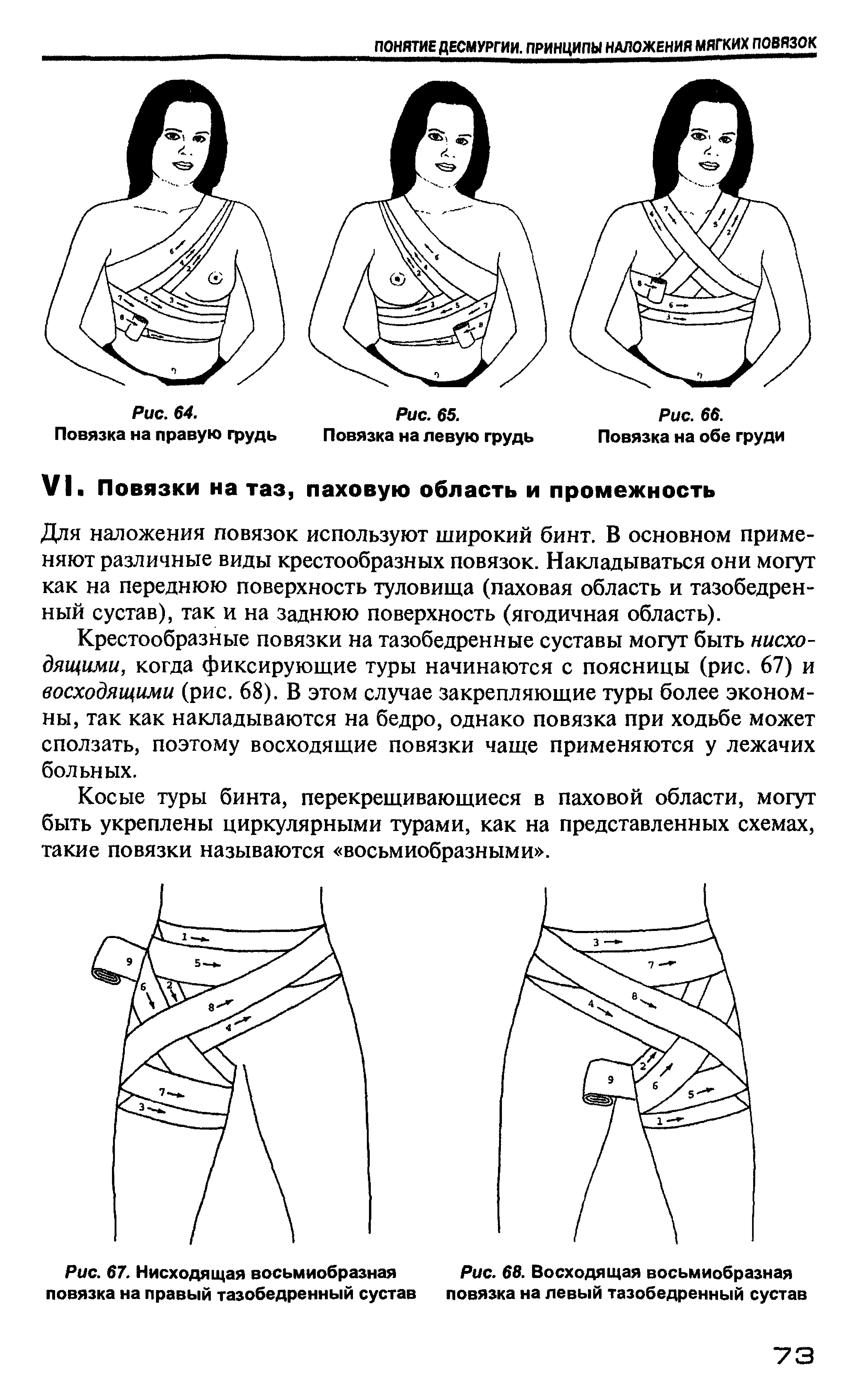 Рис. 67. Нисходящая восьмиобразная Рис. 68. Восходящая восьмиобразная повязка на правый тазобедренный сустав повязка на левый тазобедренный сустав...