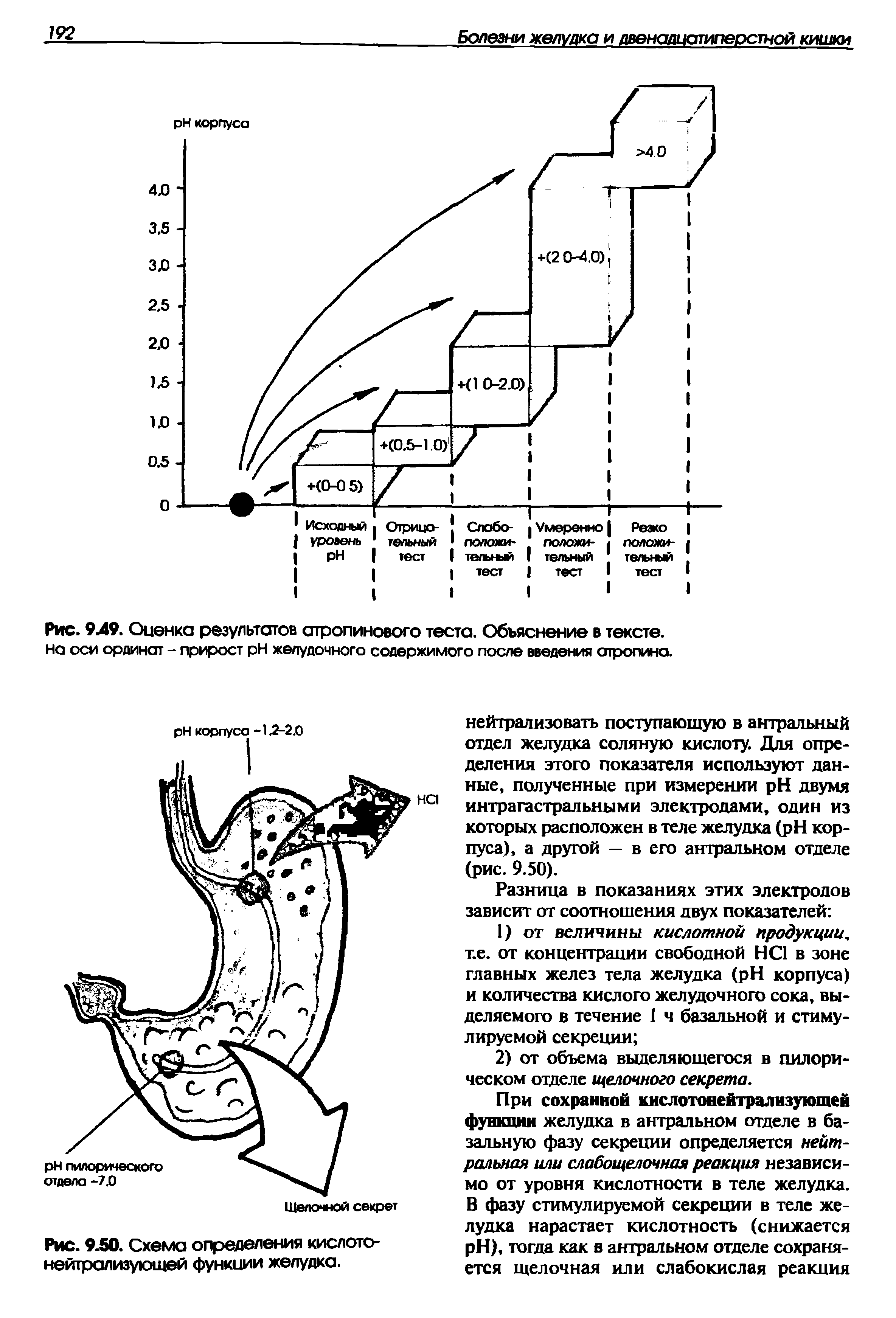 Рис. 9.49. Оценка результатов атропинового теста. Объяснение в тексте. Нс оси ординат - прирост H желудочного содержимого после введения атропина.