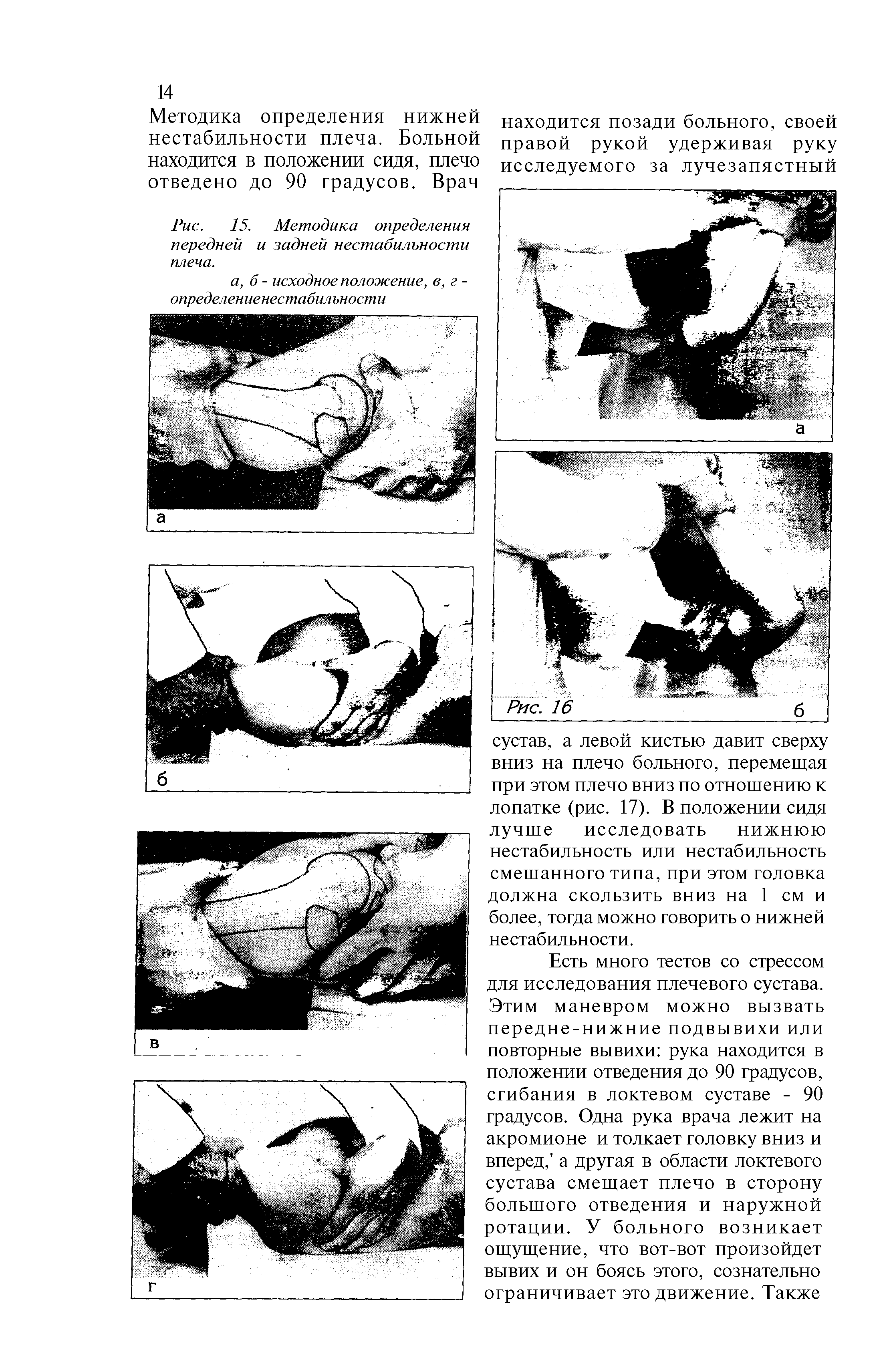 Рис. 15. Методика определения передней и задней нестабильности плеча.