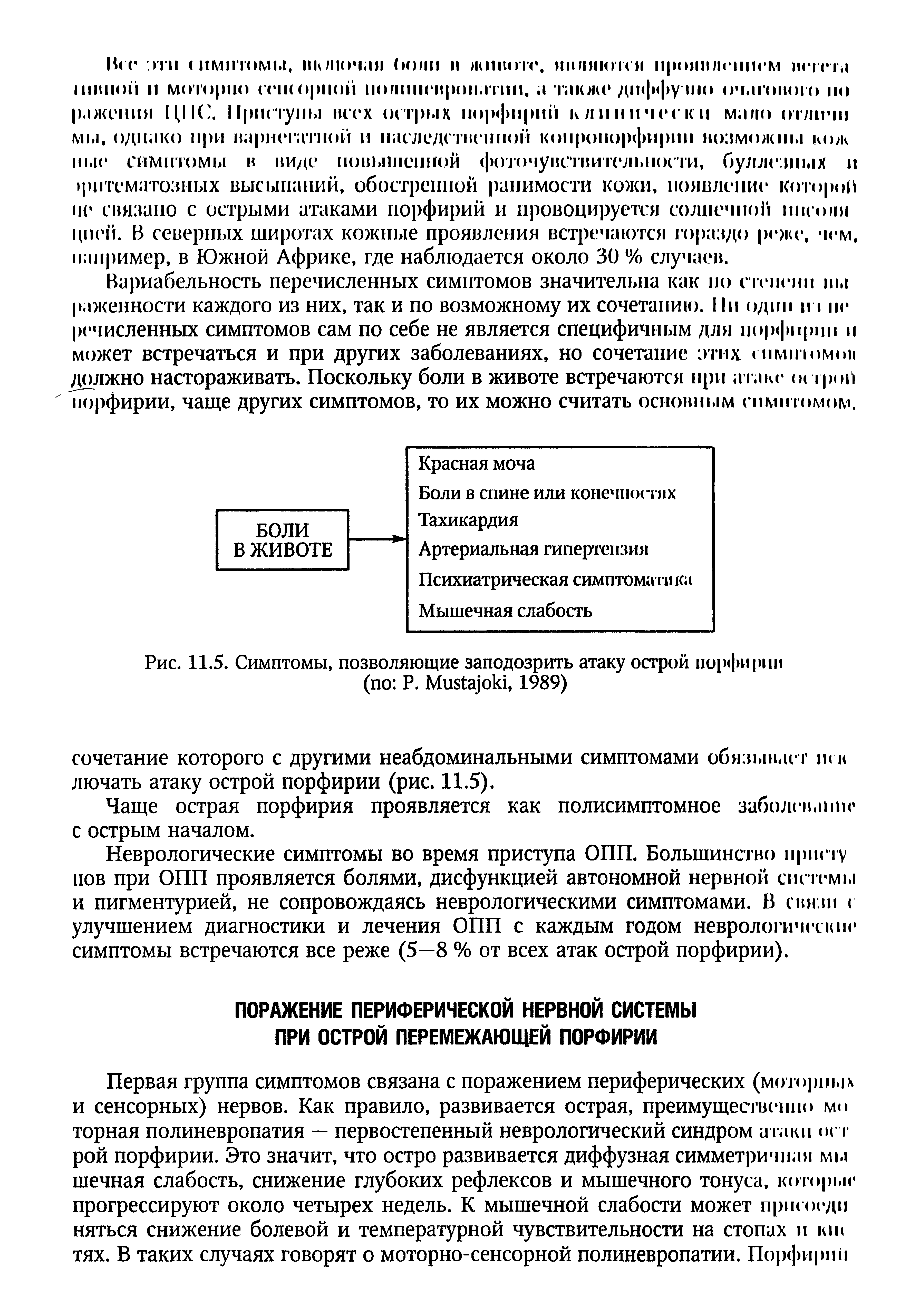 Рис. 11.5. Симптомы, позволяющие заподозрить атаку острой порфирии (по Р. M , 1989)...