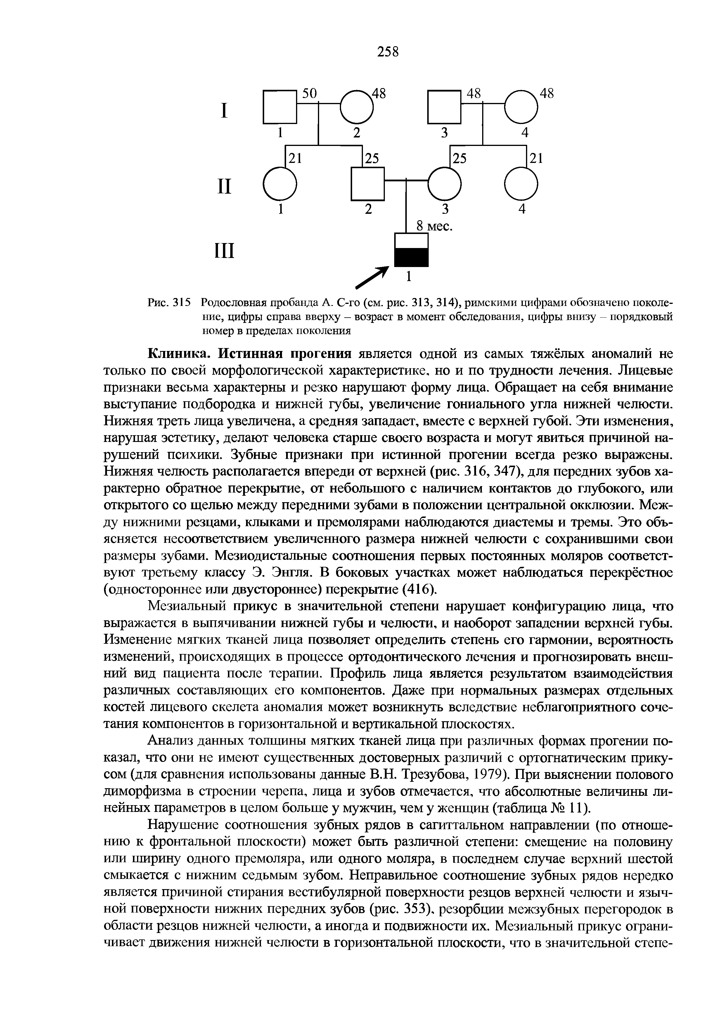 Рис. 315 Родословная пробанда А. С-го (см. рис. 313, 314), римскими цифрами обозначено поколение, цифры справа вверху — возраст в момент обследования, цифры внизу — порядковый номер в пределах поколения...