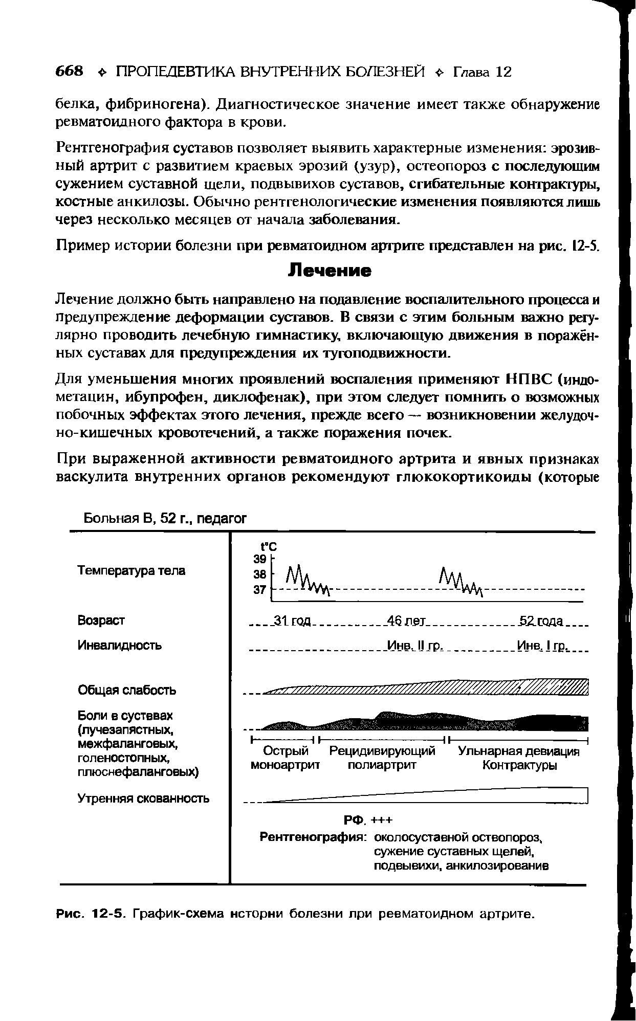 Рис. 12-5. График-схема истории болезни лри ревматоидном артрите.