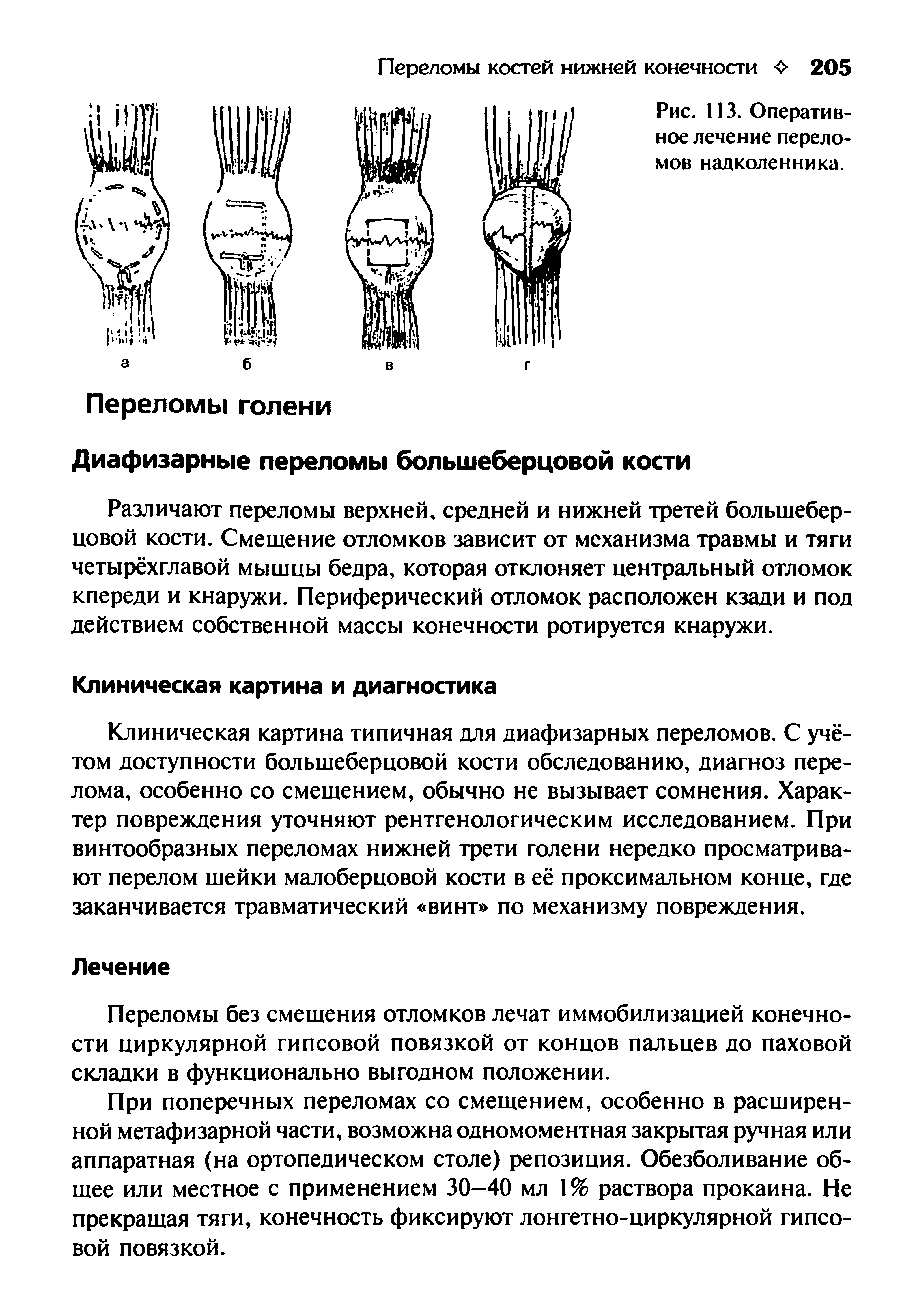 Перелом надколенника карта вызова