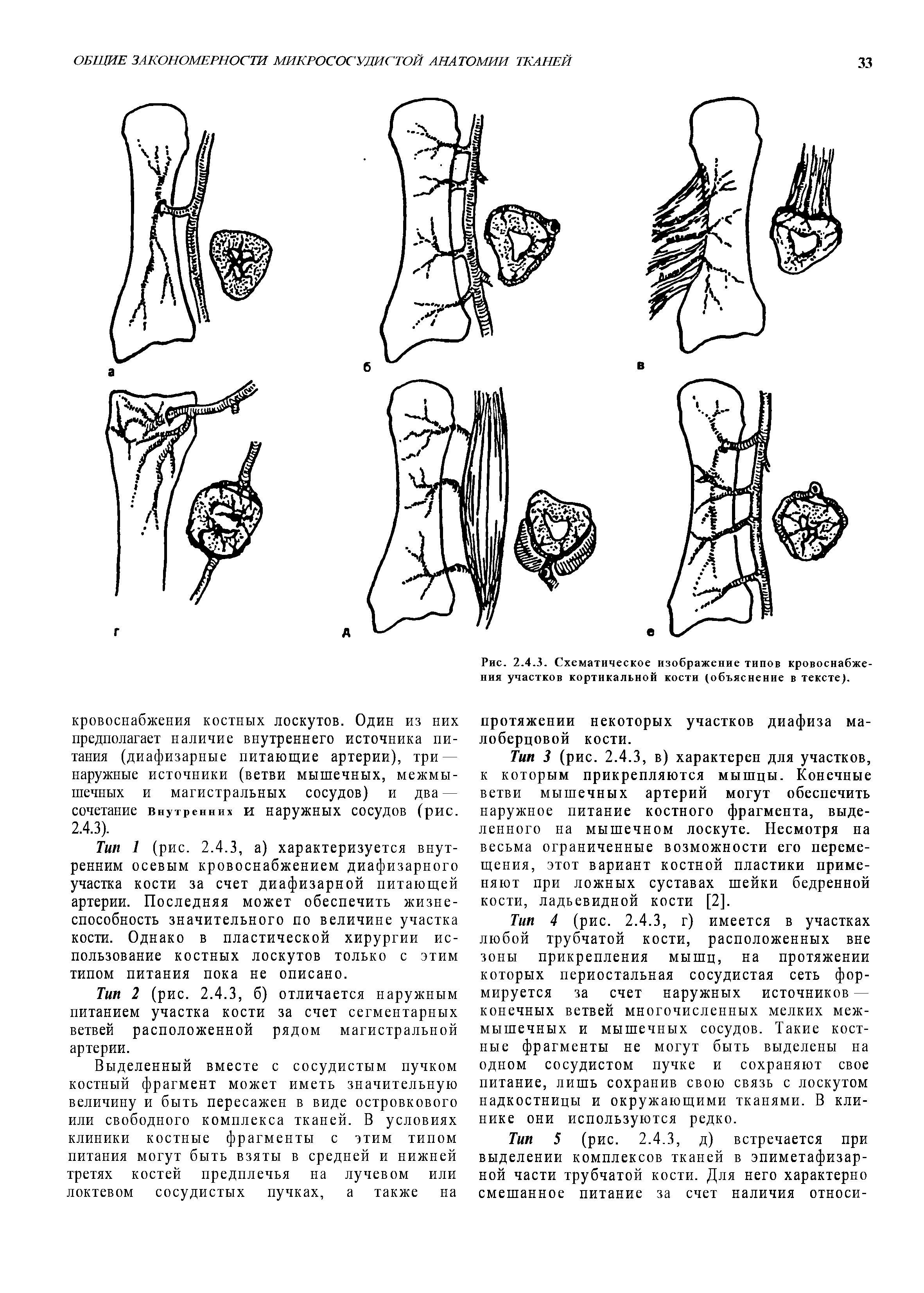 Рис. 2.4.3. Схематическое изображение типов кровоснабжения участков кортикальной кости (объяснение в тексте).