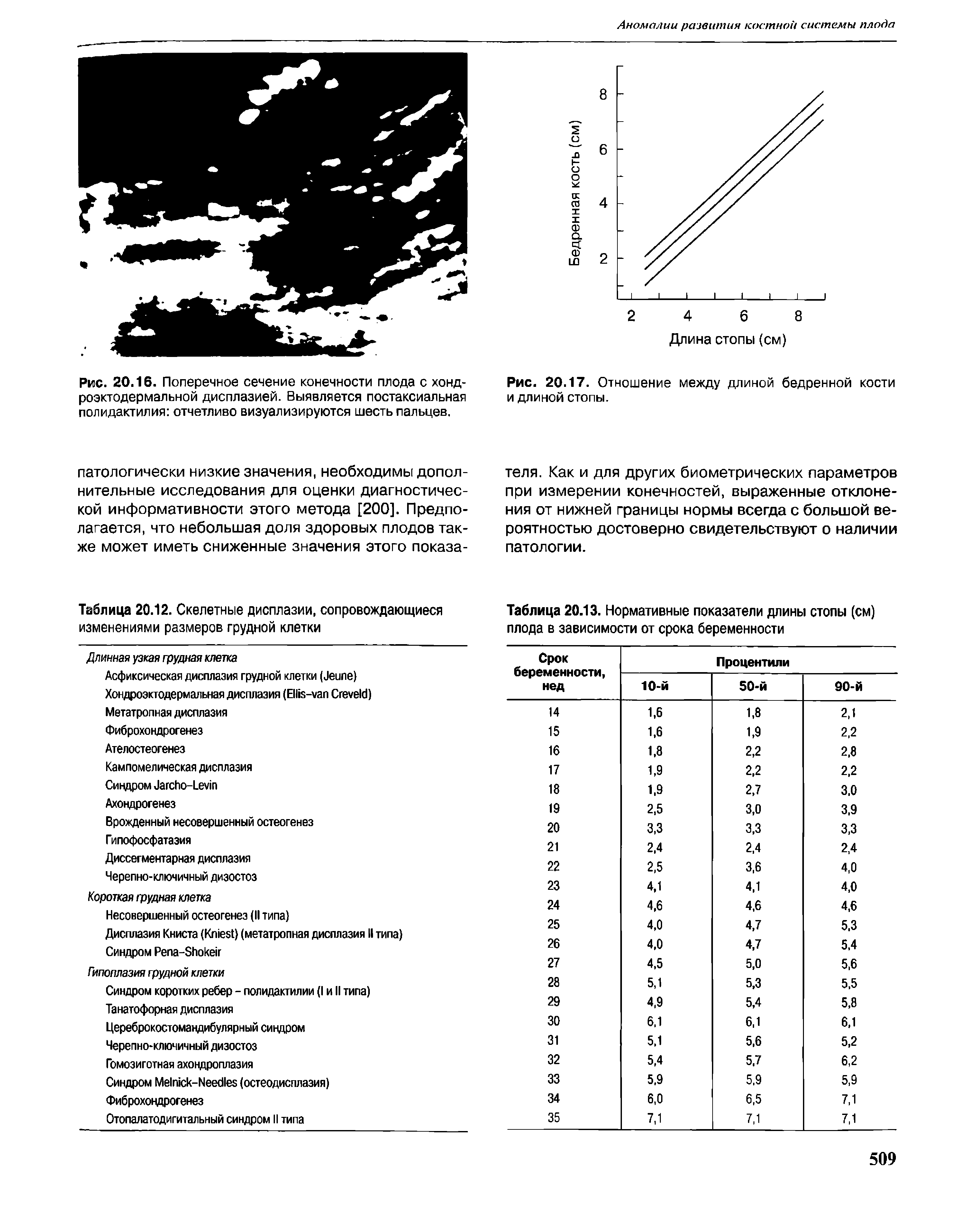 Рис. 20.17. Отношение между длиной бедренной кости и длиной стопы.