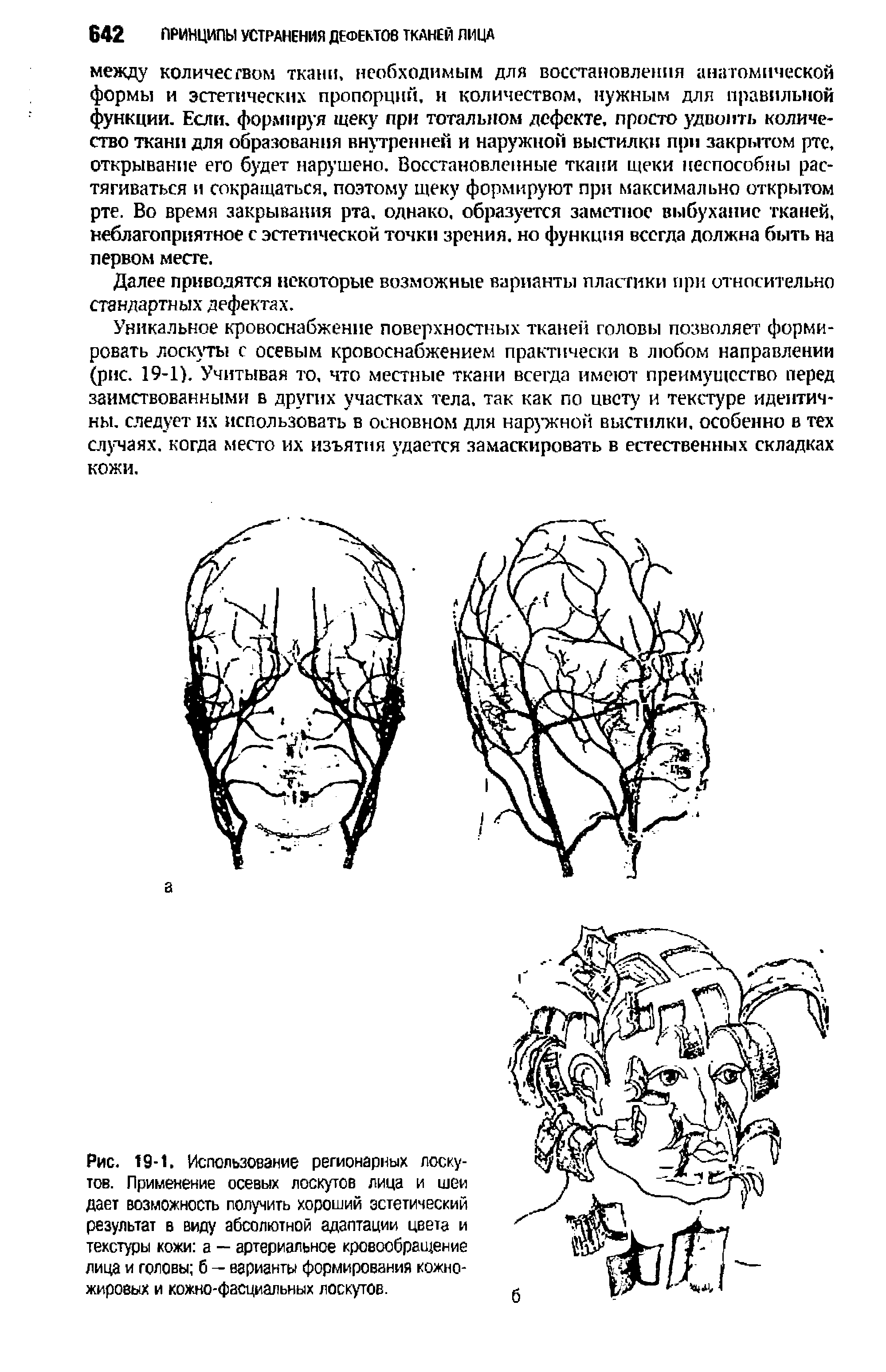 Рис. 19-1. Использование регионарных лоскутов. Применение осевых лоскутов лица и шеи дает возможность получить хороший эстетический результат в виду абсолютной адаптации цвета и текстуры кожи а — артериальное кровообращение лица и головы б — варианты формирования кожножировых и кожно-фасциальных лоскутов.