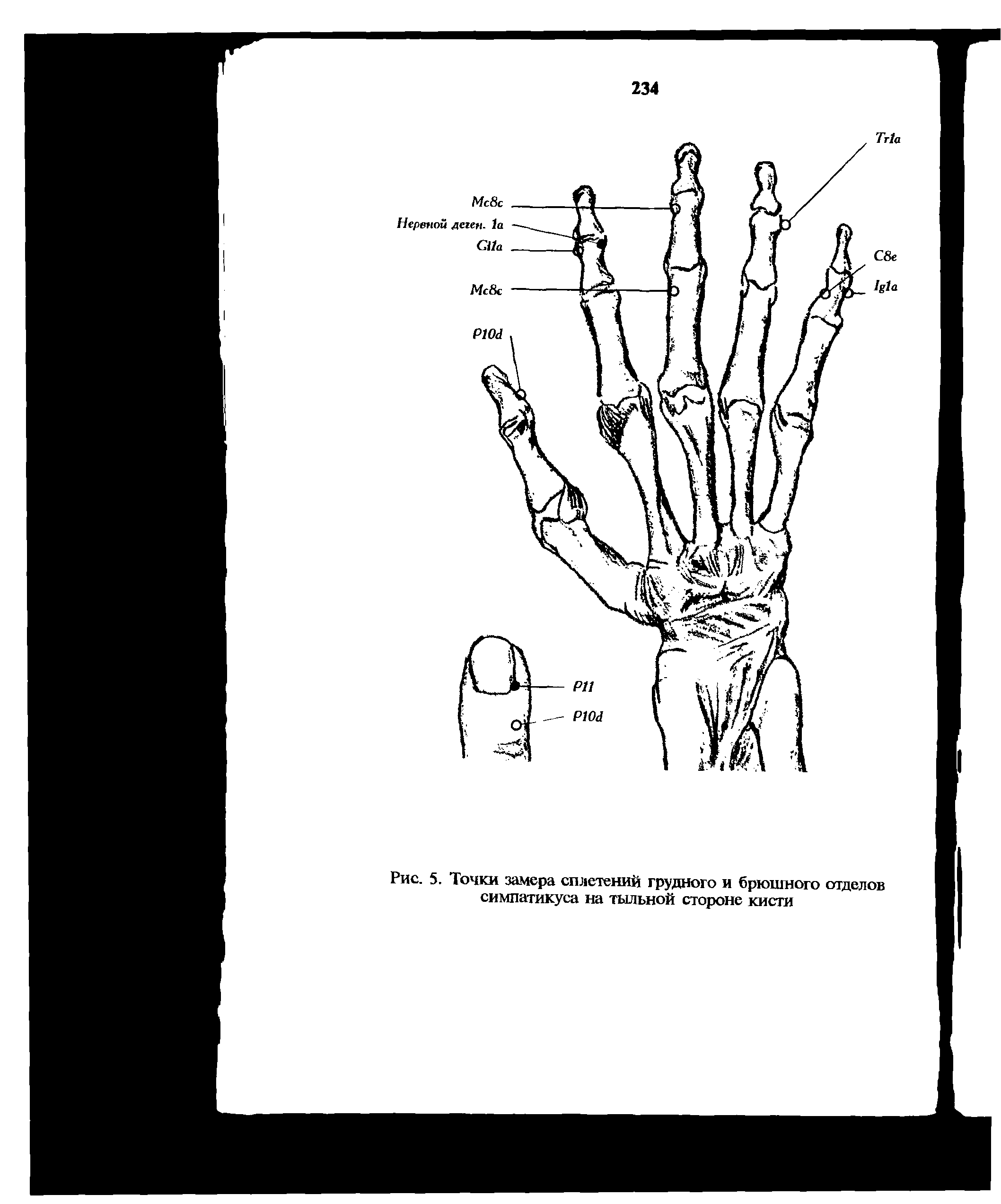 Рис. 5. Точки замера сплетений грудного и брюшного отделов симпатикуса на тыльной стороне кисти...