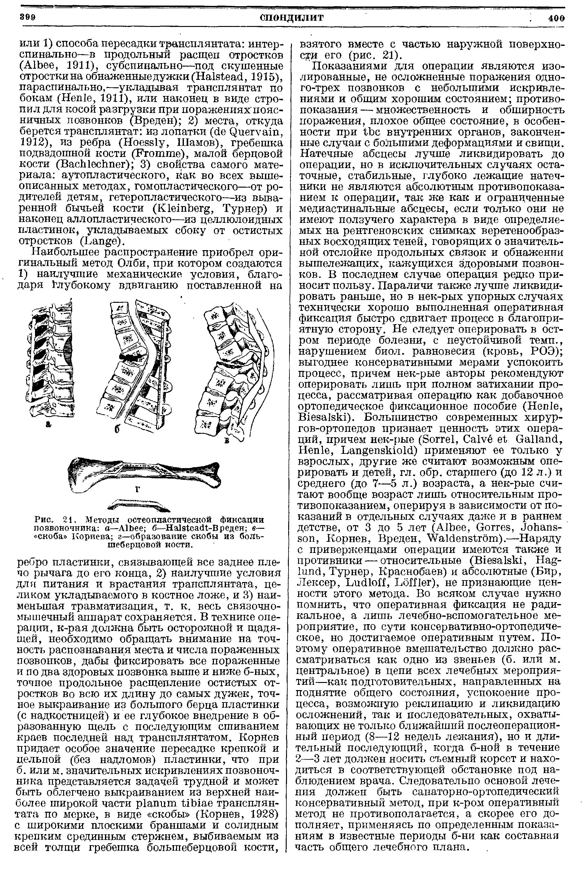 Рис. 21. Методы остеопластической фиксации позвоночника —A б—H -Вреден в— скоба Корнева г—образование скобы из большеберцовой кости.