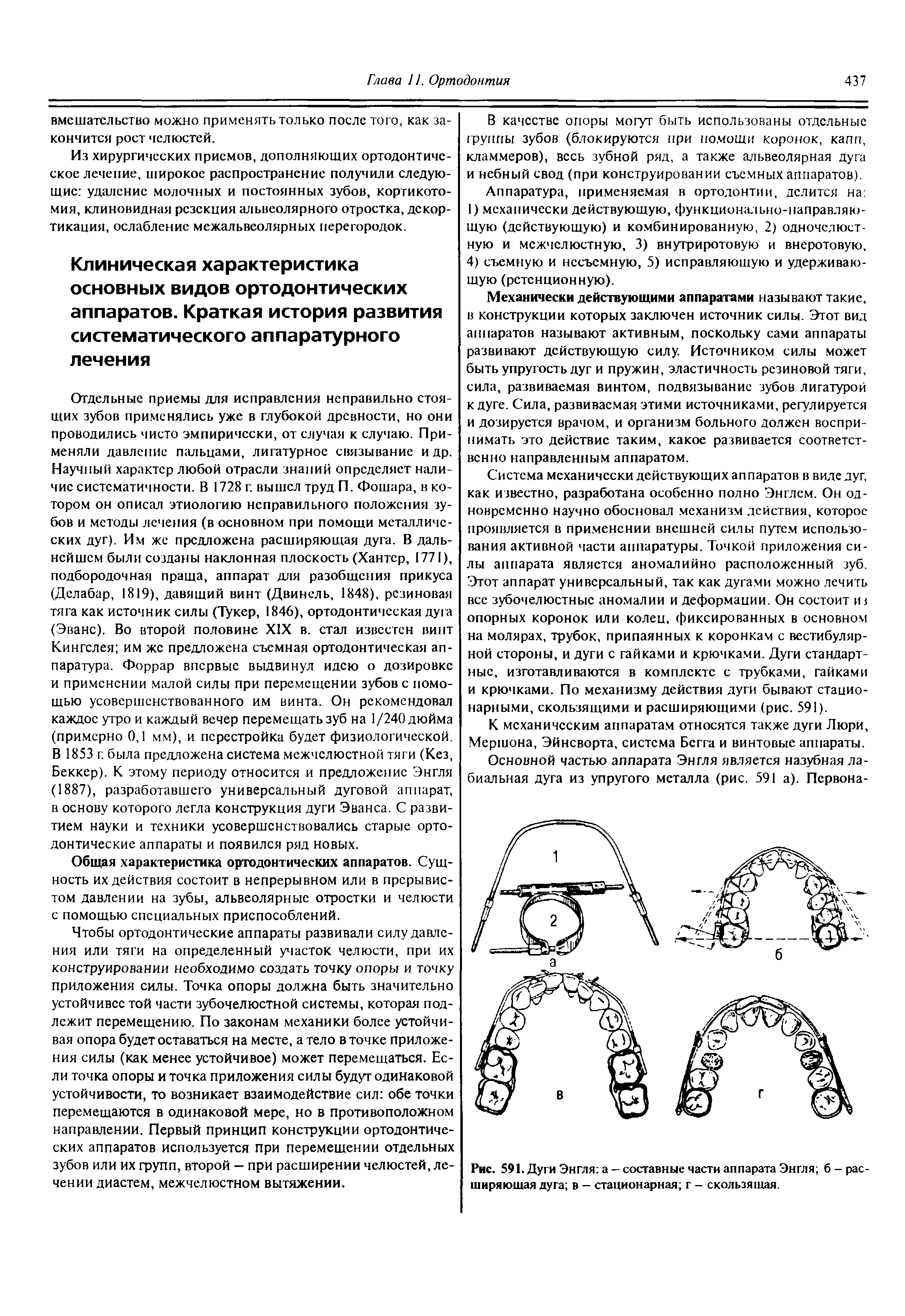 Рис. 591. Дуги Энгля а - составные части аппарата Энгля б - расширяющая дуга в — стационарная г - скользящая.