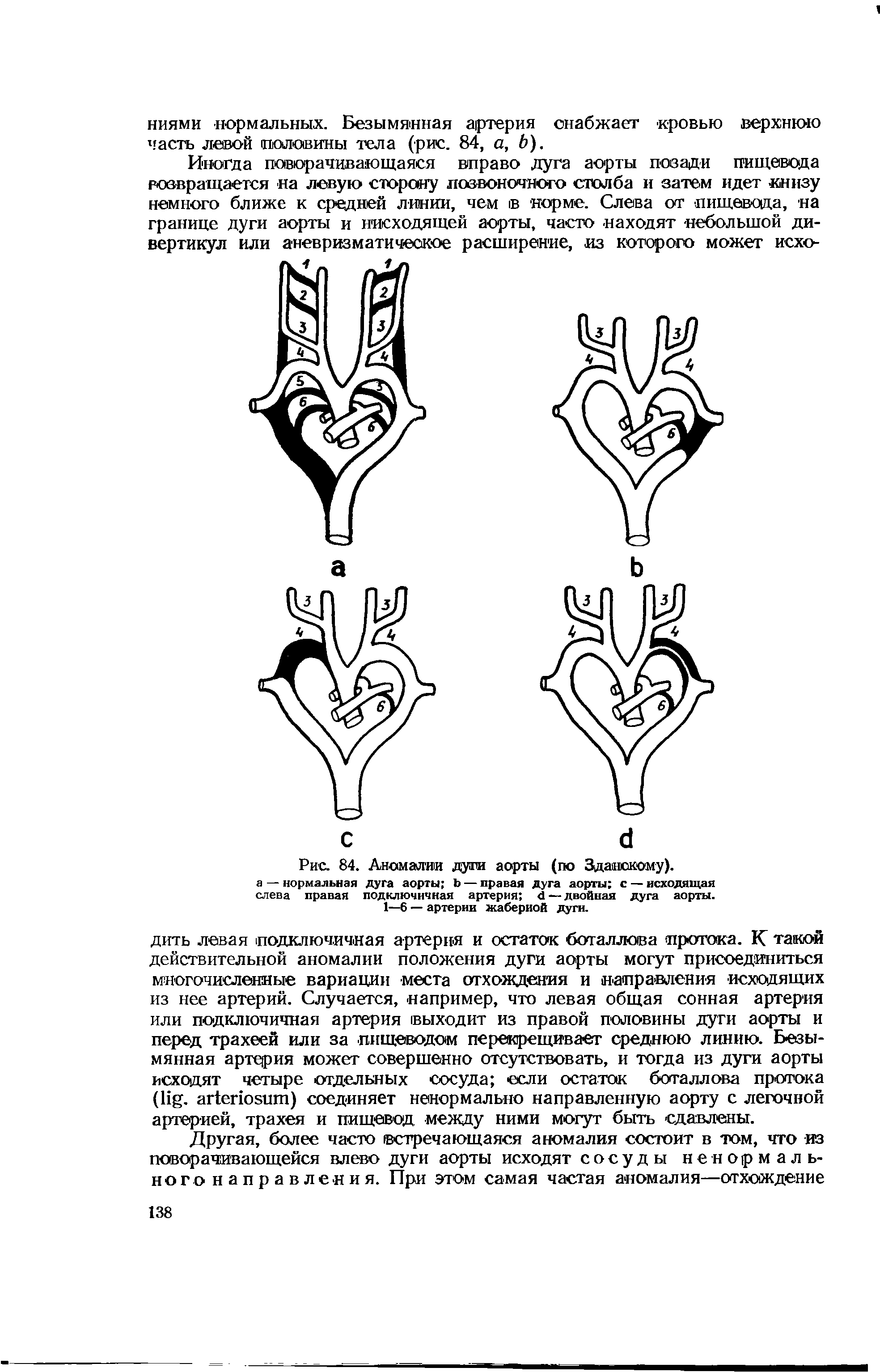 Рис. 84. Аномалии души аорты (по Зданокому). а —нормальная дуга аорты Ь — правая дуга аорты с —исходящая слева правая подключичная артерия <1 — двойная дуга аорты.