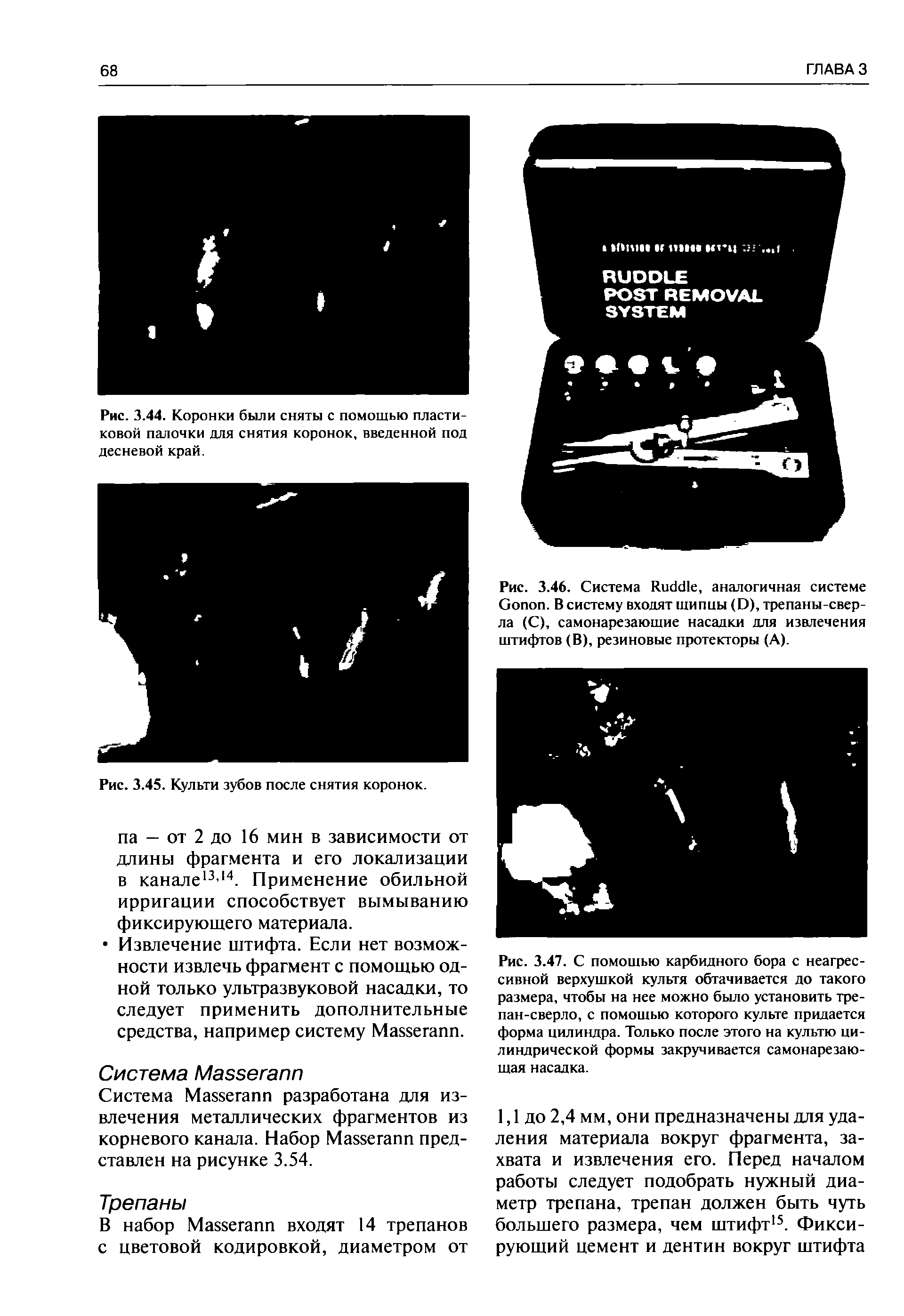 Рис. 3.46. Система R , аналогичная системе G . В систему входят щипцы (D), трепаны-сверла (С), самонарезающие насадки для извлечения штифтов (В), резиновые протекторы (А).