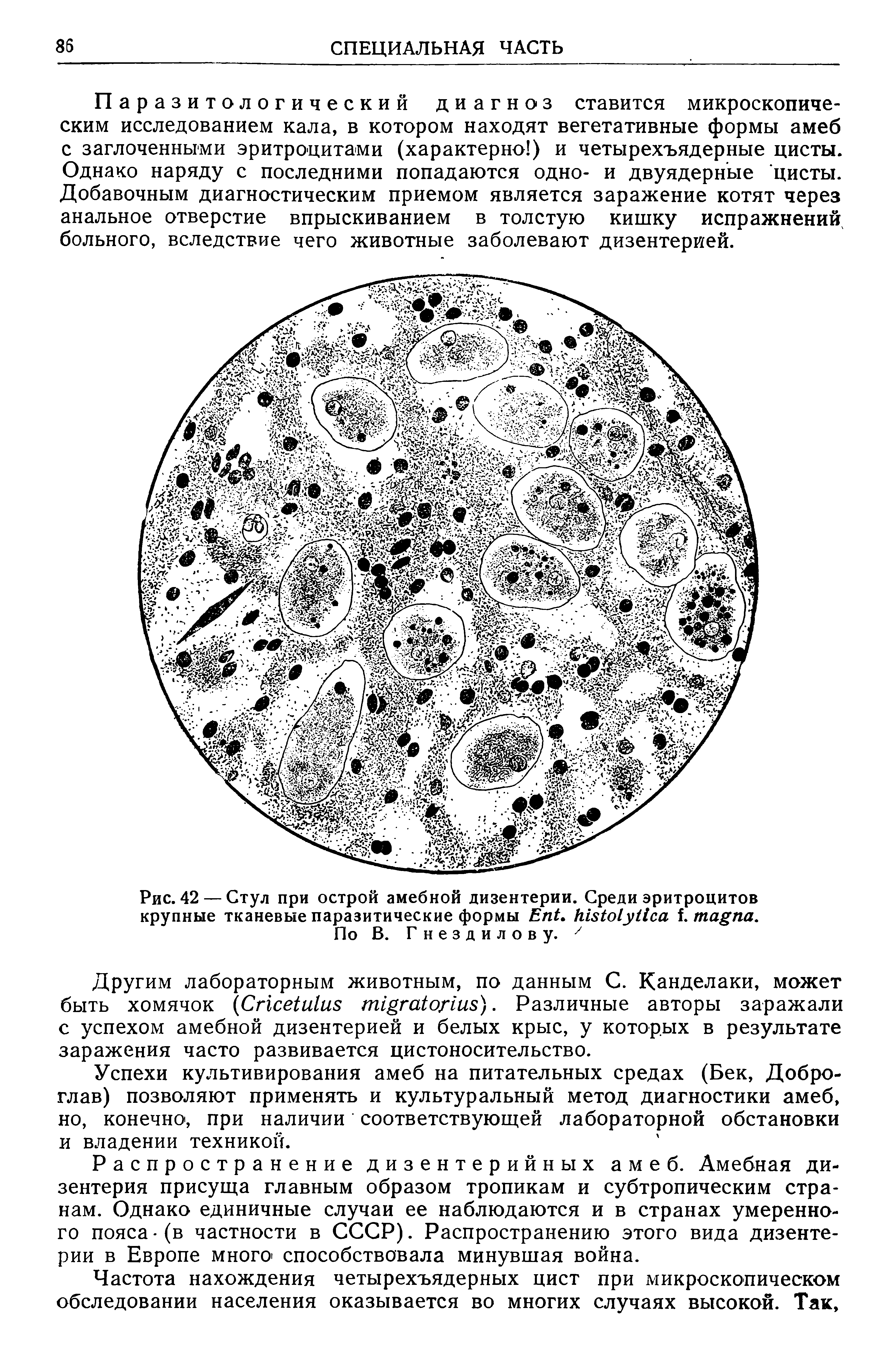 Рис. 42 — Стул при острой амебной дизентерии. Среди эритроцитов крупные тканевые паразитические формы E . . .