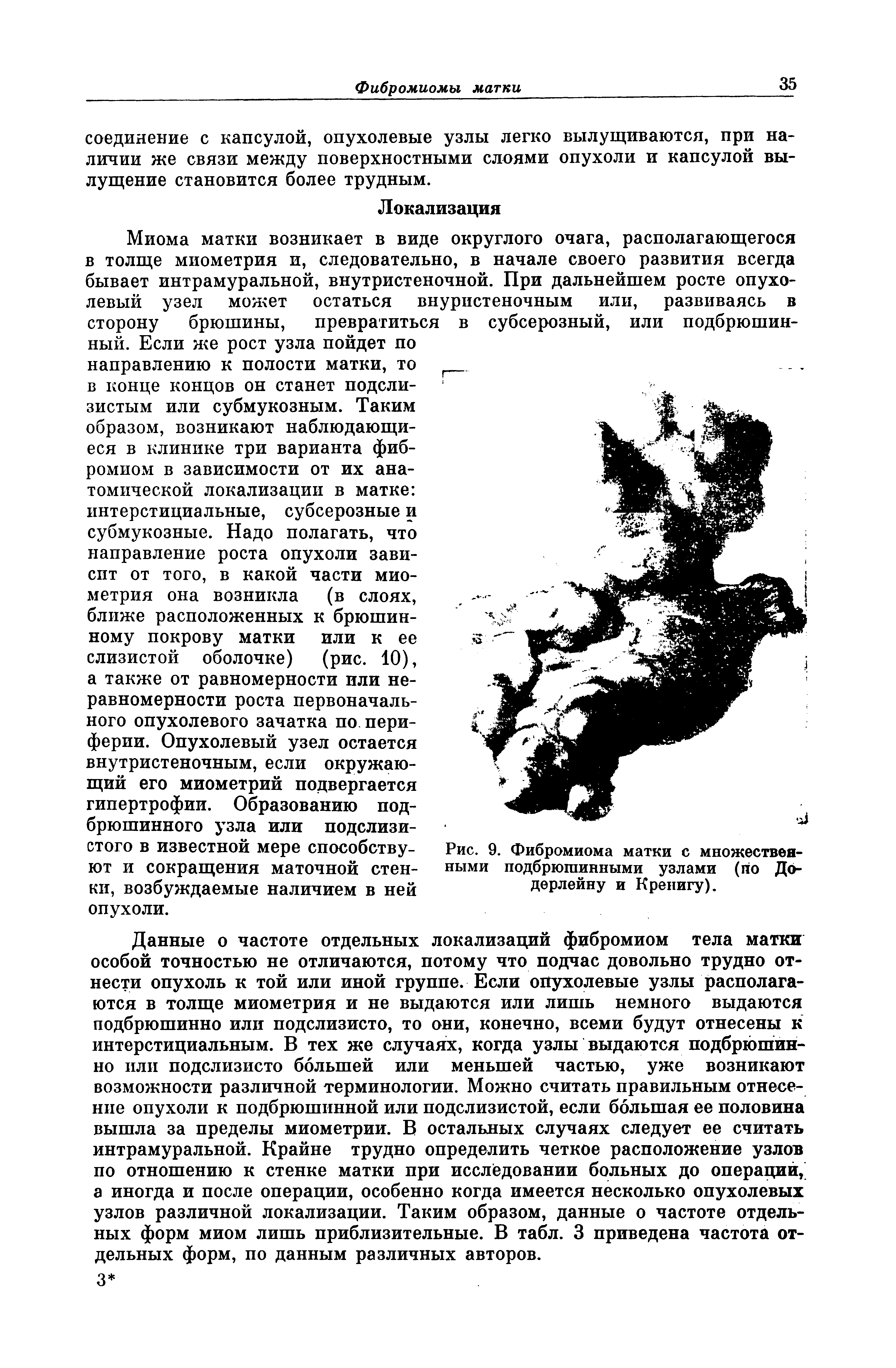 Рис. 9. Фибромиома матки с множественными подбрюгаинными узлами (по До-дерлейну и Креиигу).