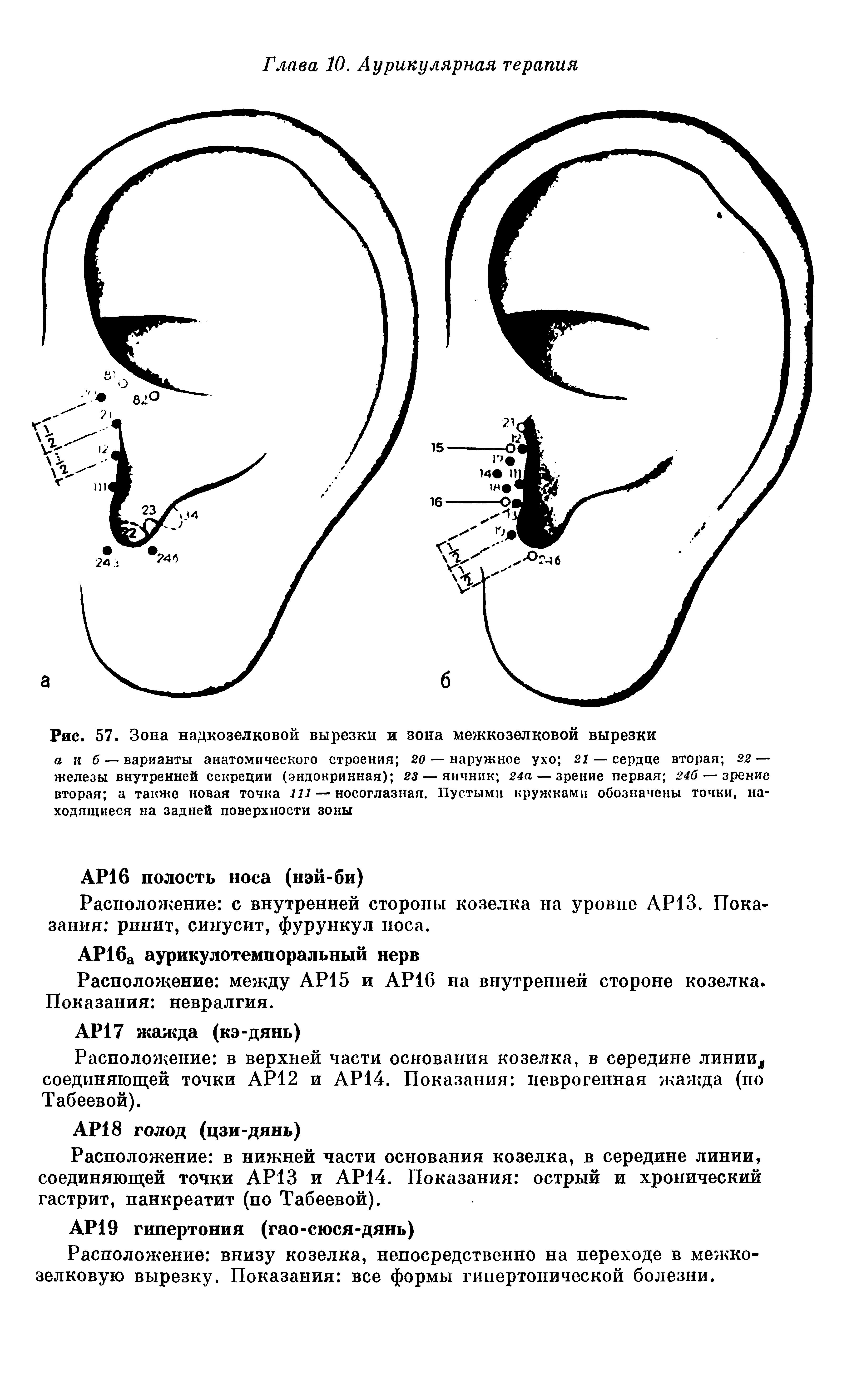 Рис. 57. Зона надкозел ковой вырезки и зона межкозелковой вырезки...