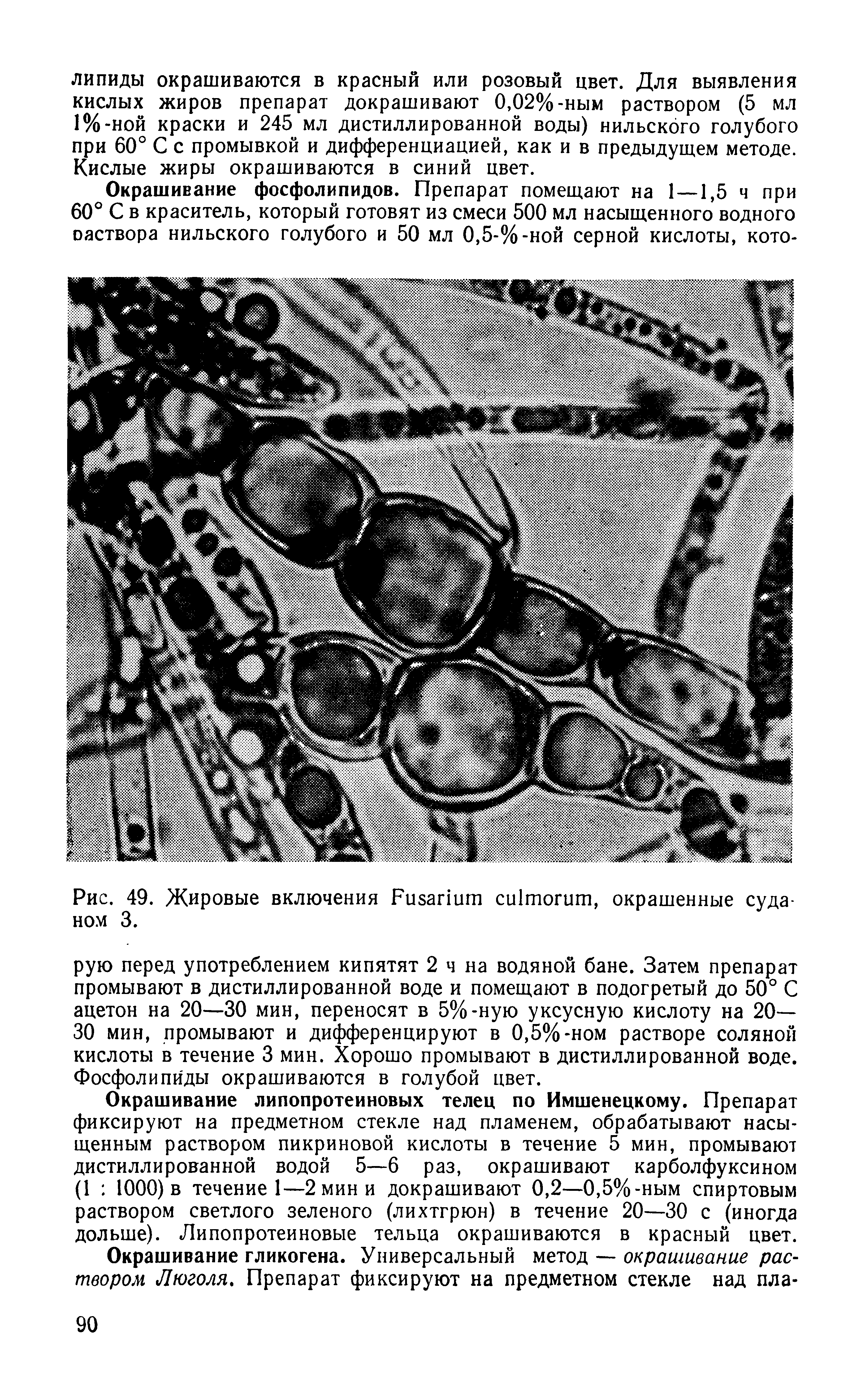 Рис. 49. Жировые включения F , окрашенные Суданом 3.