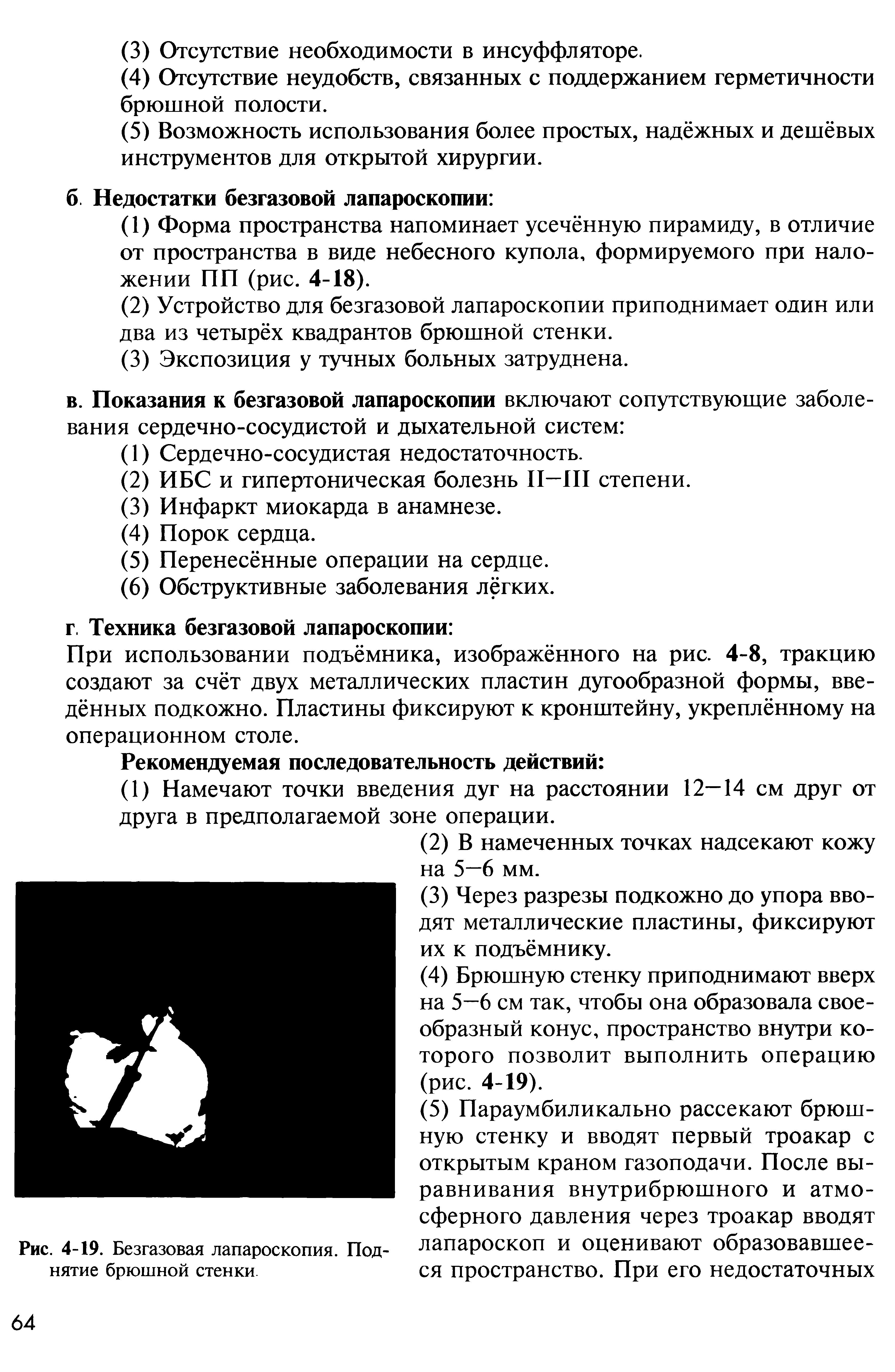 Рис. 4-19. Безгазовая лапароскопия. Под- лапароскоп и оценивают образовавшее-нятие брюшной стенки ся пространство. При его недостаточных...