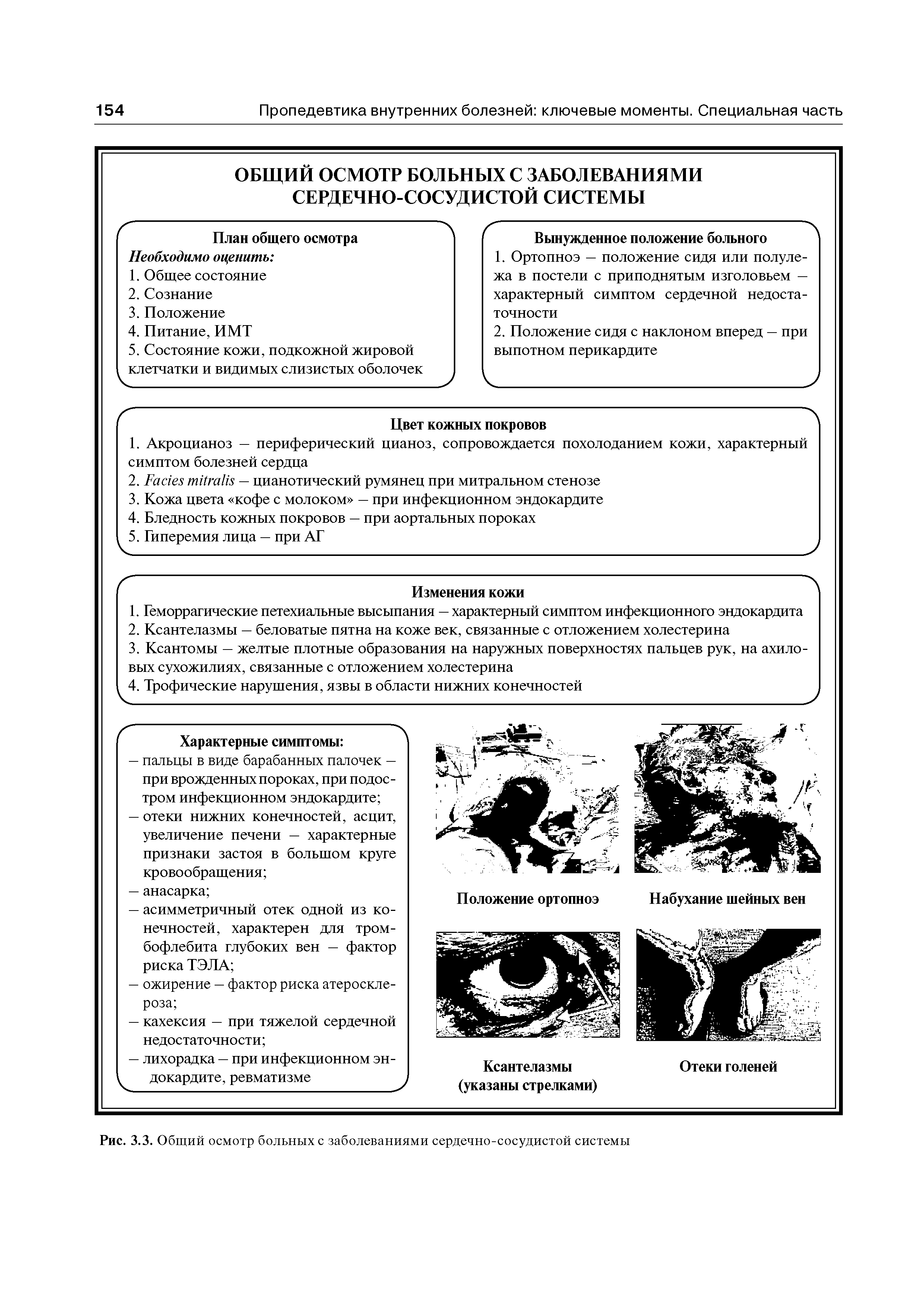 Рис. 3.3. Общий осмотр больных с заболеваниями сердечно-сосудистой системы...