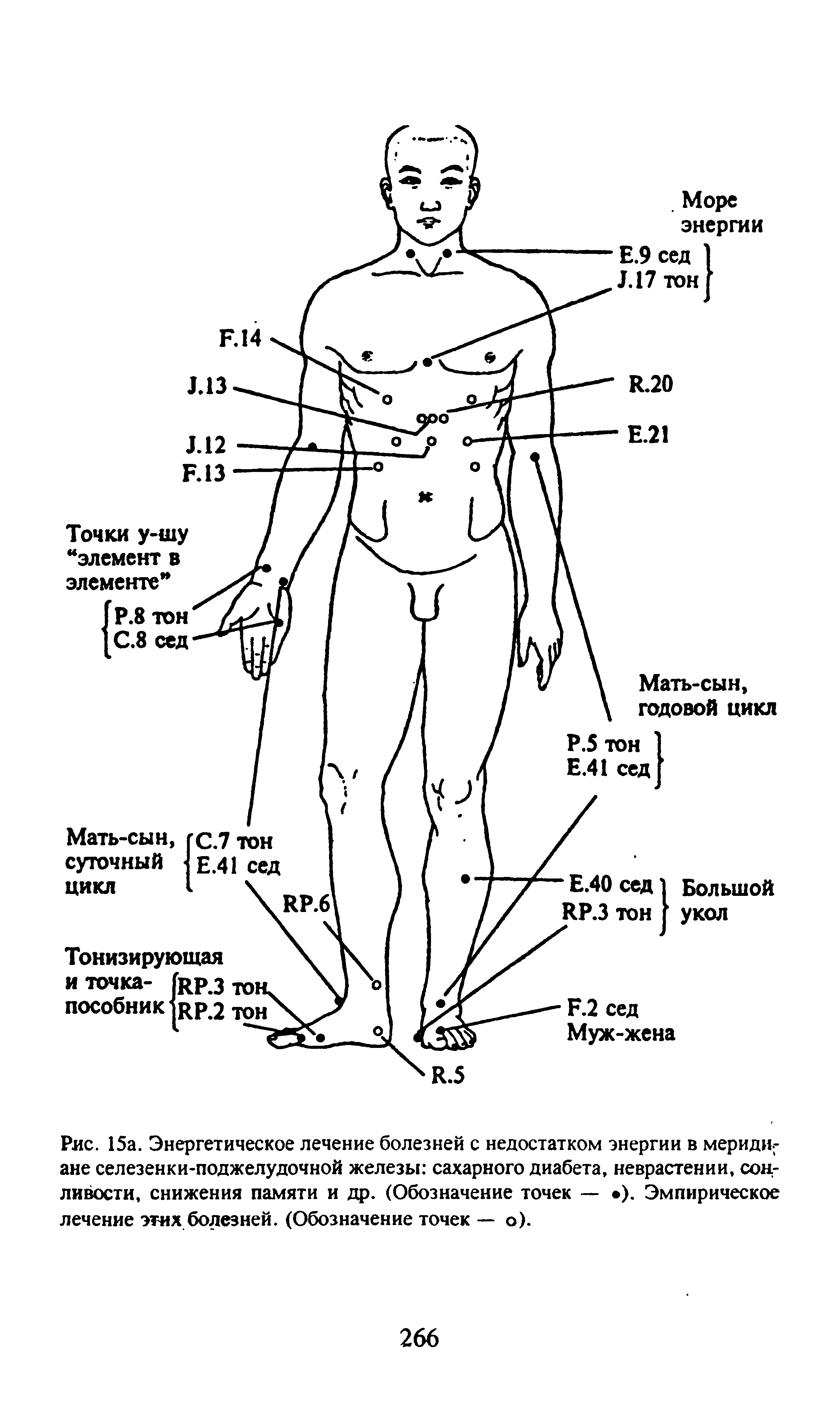 Рис. 15а. Энергетическое лечение болезней с недостатком энергии в меридиане селезенки-поджелудочной железы сахарного диабета, неврастении, сонливости, снижения памяти и др. (Обозначение точек — ). Эмпирическое лечение этих болезней. (Обозначение точек — о).