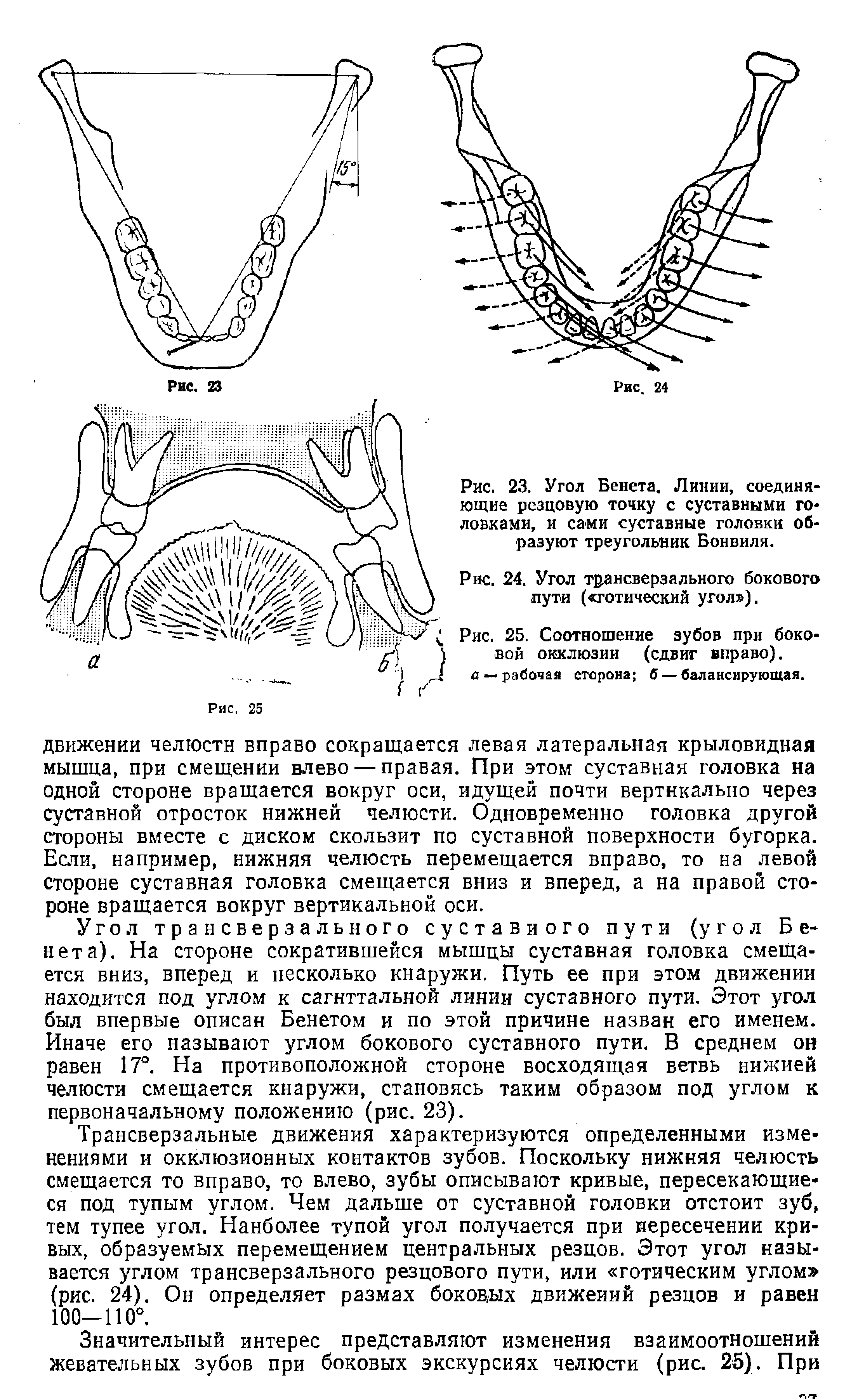 Рис. 25. Соотношение зубов при боковой окклюзии (сдвиг вправо).