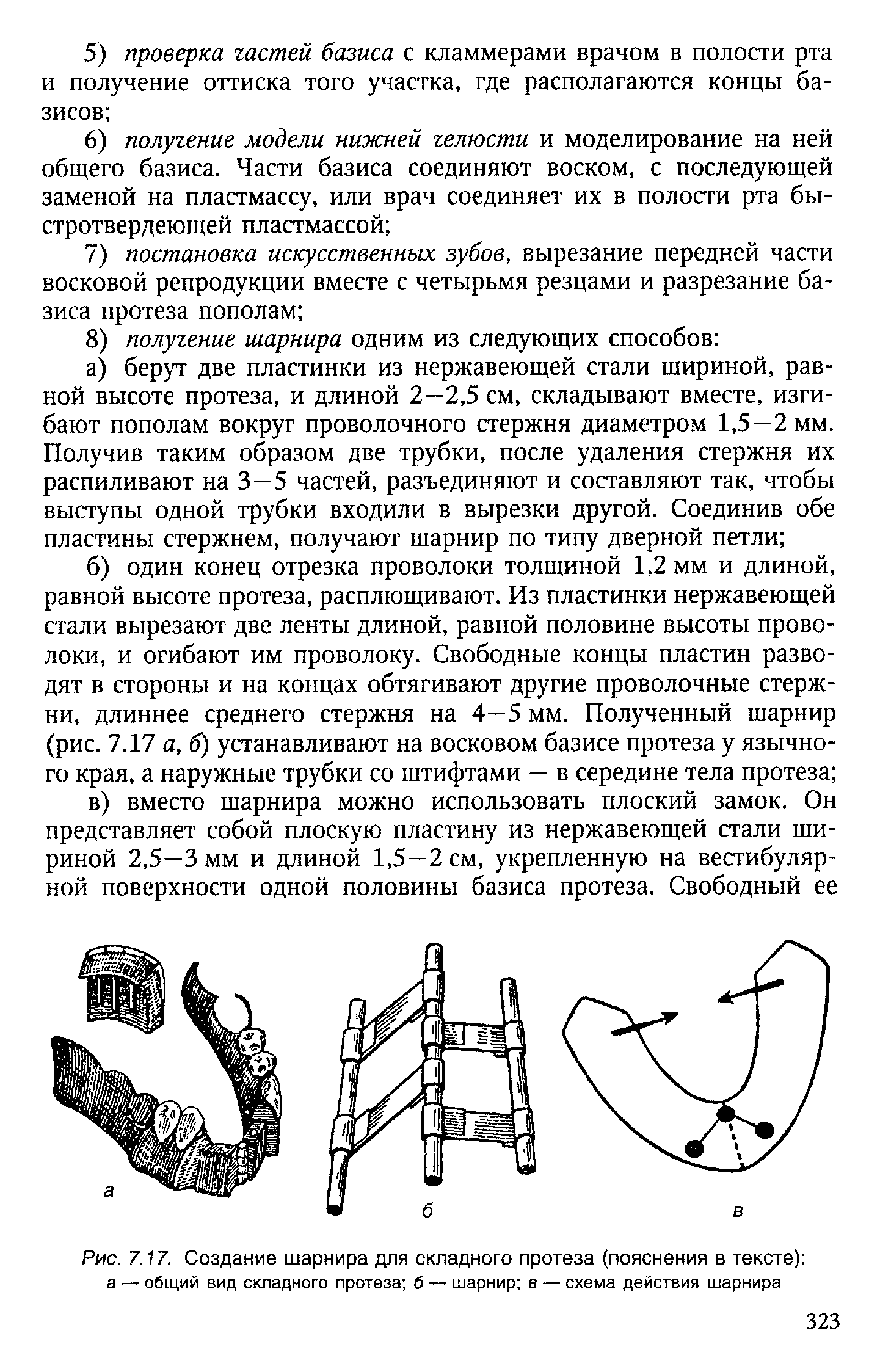 Рис. 7.17. Создание шарнира для складного протеза (пояснения в тексте) а — общий вид складного протеза б — шарнир в — схема действия шарнира...