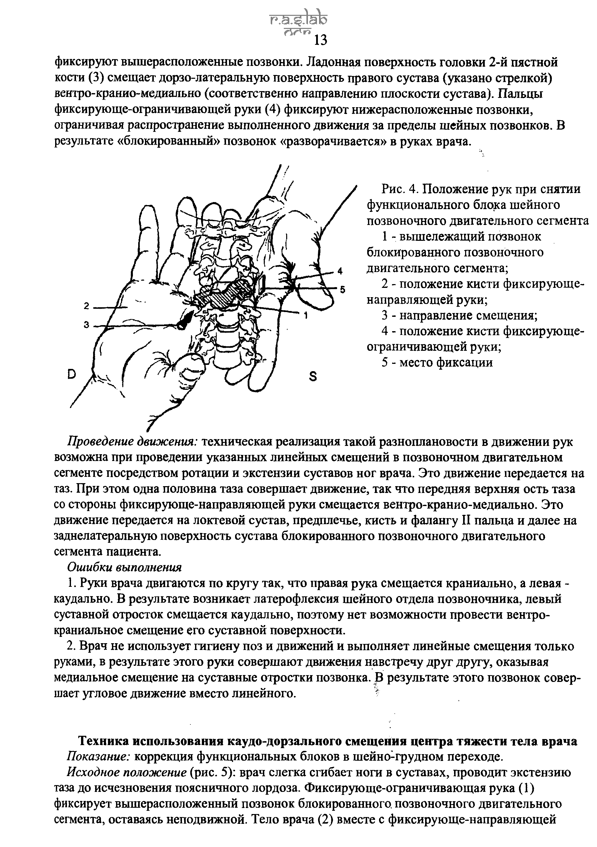 Рис. 4. Положение рук при снятии функционального блока шейного позвоночного двигательного сегмента...