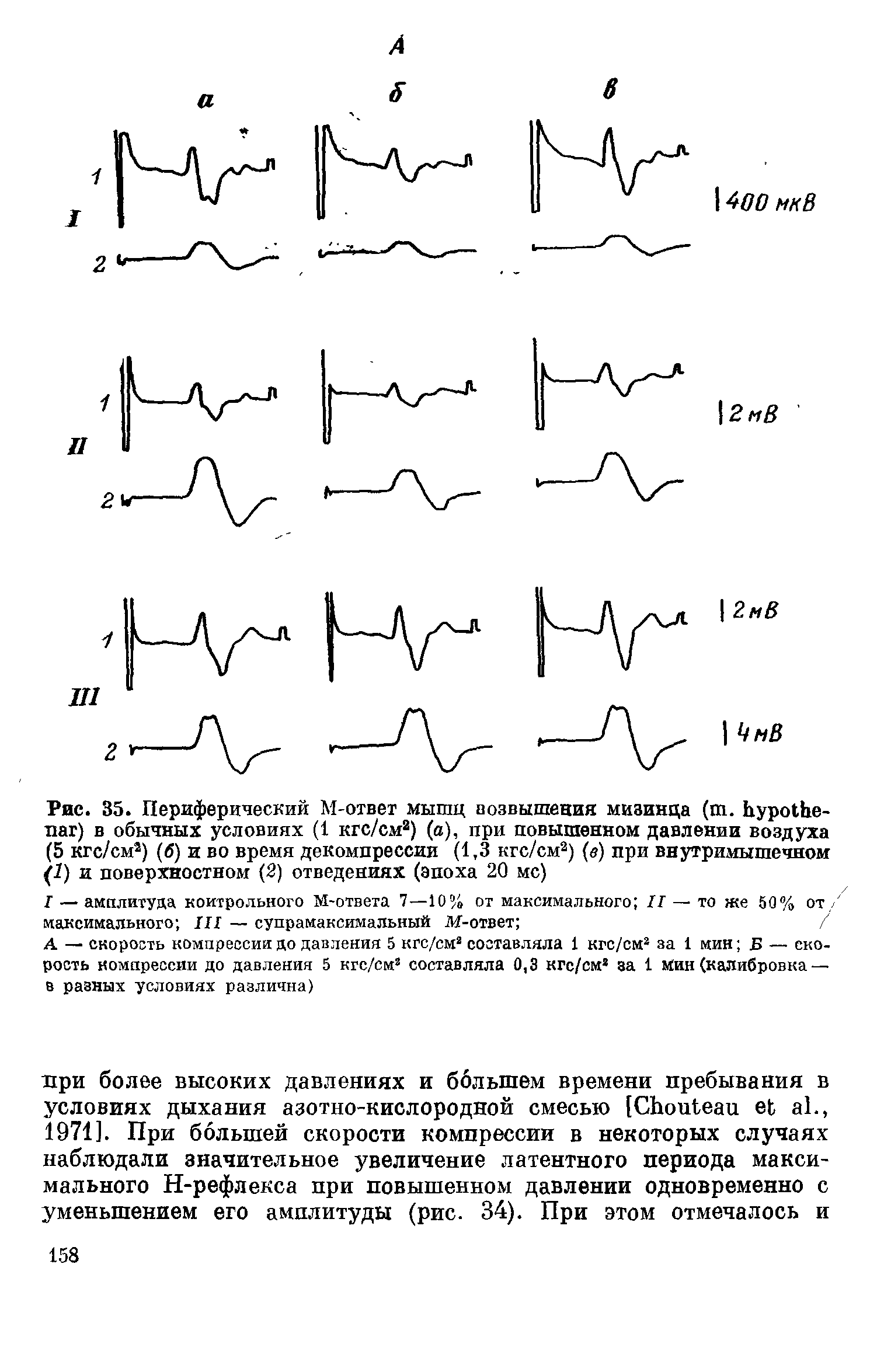 Рис. 35. Периферический М-ответ мышц возвышения мизинца ( . ) в обычных условиях (1 кгс/см2) (а), при повышенном давлении воздуха (5 кгс/см2) (б) и во время декомпрессии (1,3 кгс/см2) (в) при внутримышечном (1) и поверхностном (2) отведениях (эпоха 20 мс)...