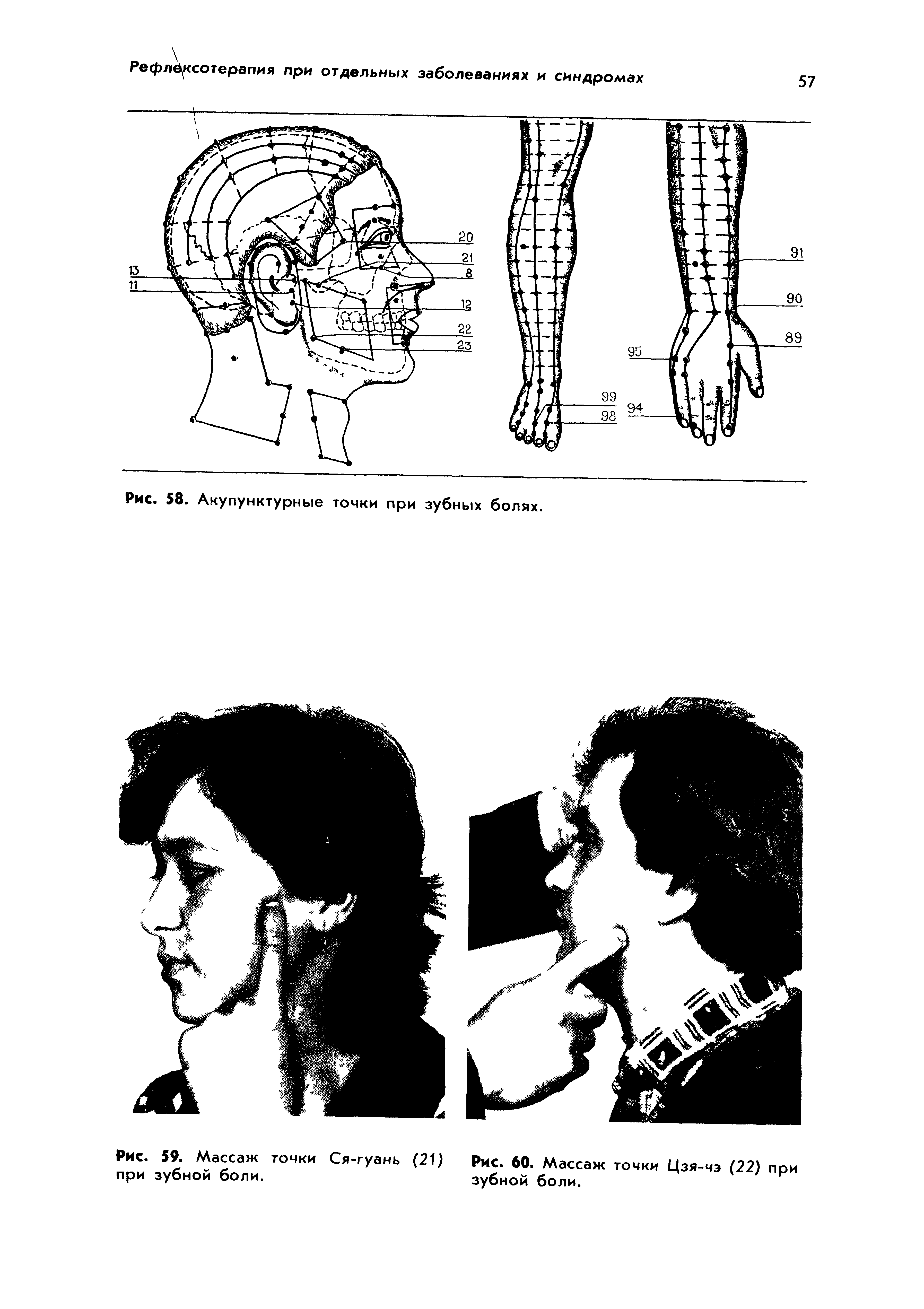 Рис. 59. Массаж точки Ся-гуань (21) Рис. 60. Массаж точки Цзя-чэ (22) при при зубной боли. зубной боли.