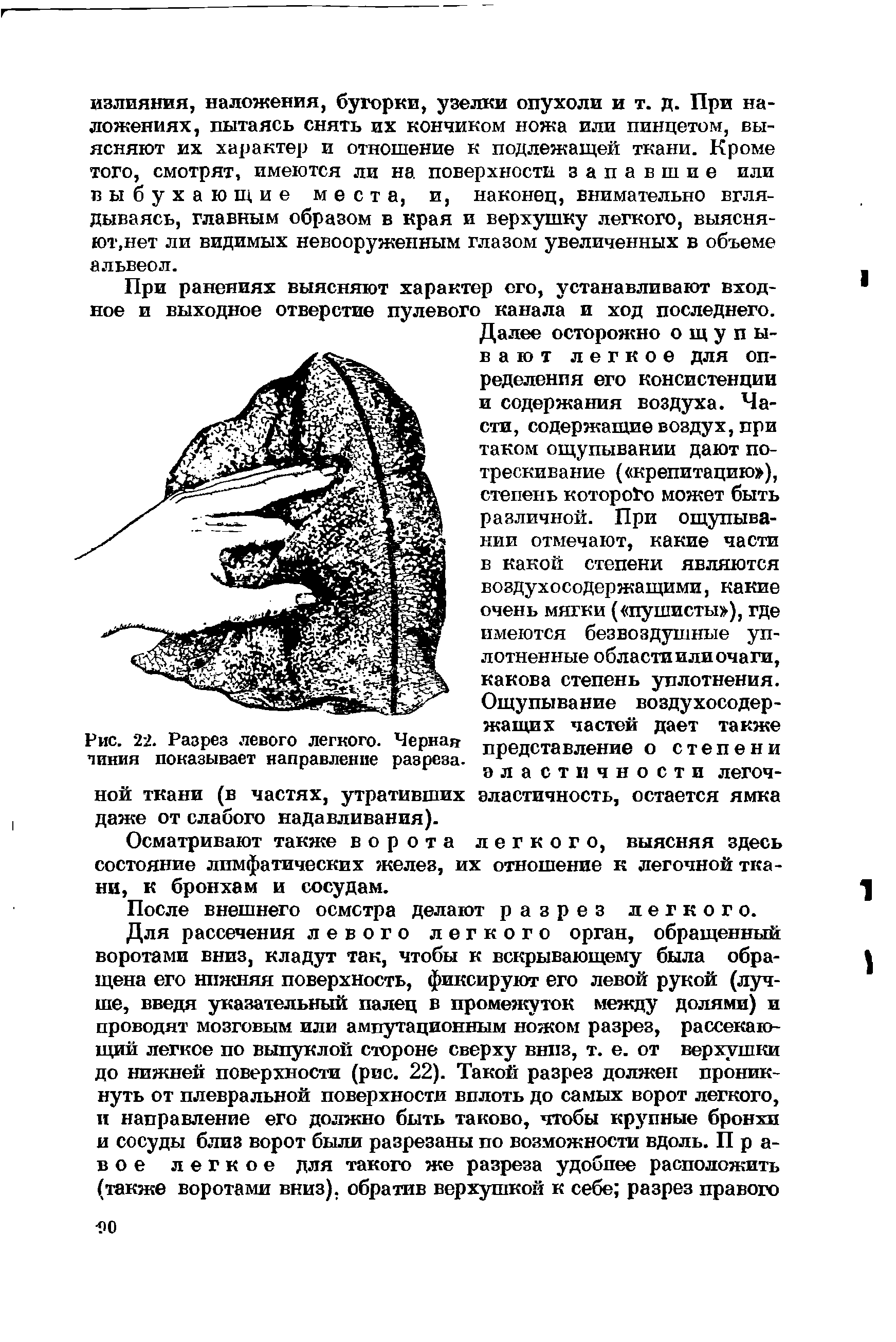 Рис. 22. Разрез левого легкого. Черная пиния показывает направление разреза.