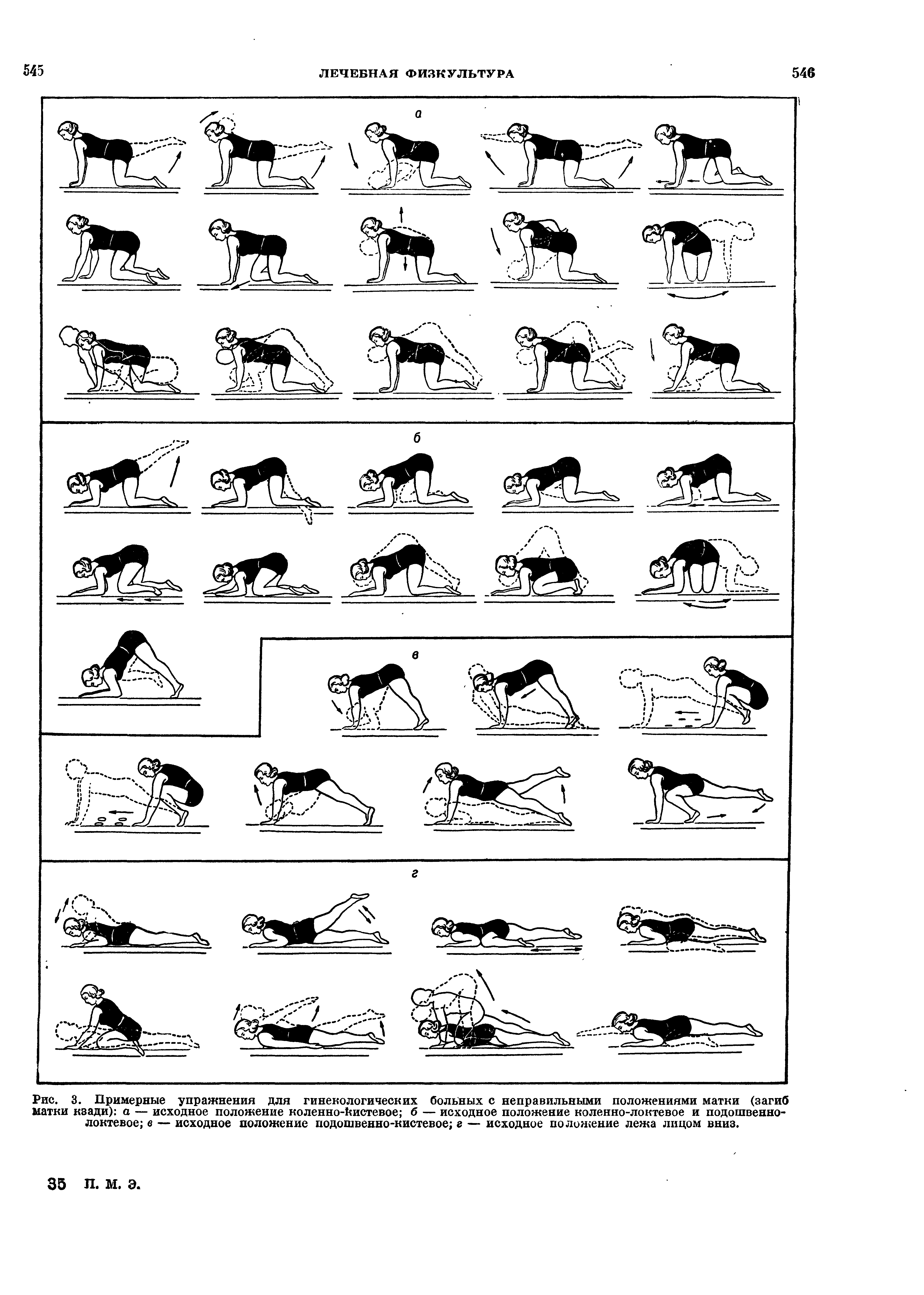 Рис. 3. Примерные упражнения для гинекологических больных с неправильными положениями матки (загиб матки кзади) а — исходное положение коленно-йистевое б — исходное положение коленно-локтевое и подошвеннолоктевое в — исходное положение подошвенно-кистевое г — исходное положение лежа лицом вниз.