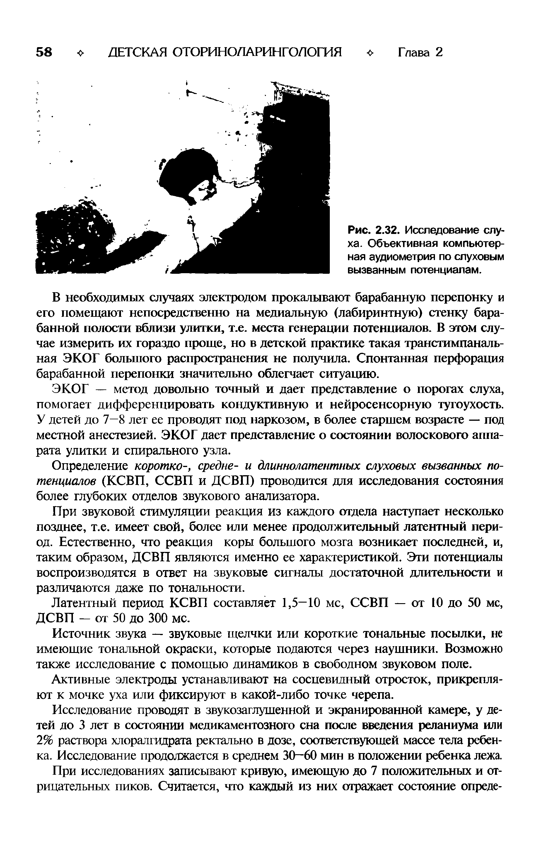 Рис. 2.32. Исследование слуха. Объективная компьютерная аудиометрия по слуховым вызванным потенциалам.