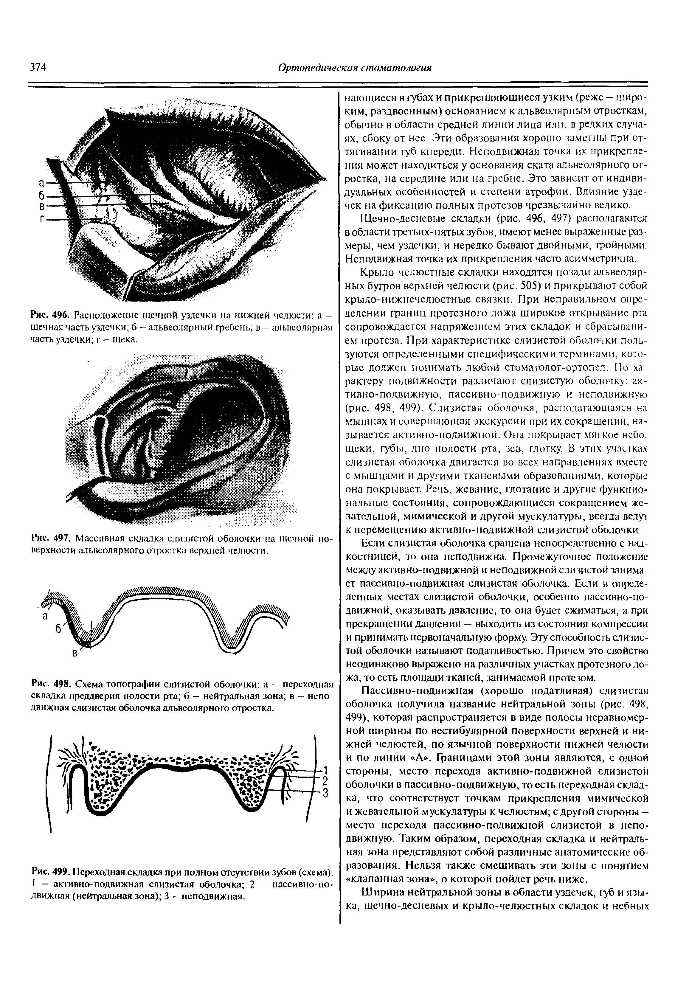 Рис. 498. Схема топографии слизистой оболочки а — переходная складка преддверия полости рта б — нейтральная зона в - неподвижная слизистая оболочка альвеолярного отростка.