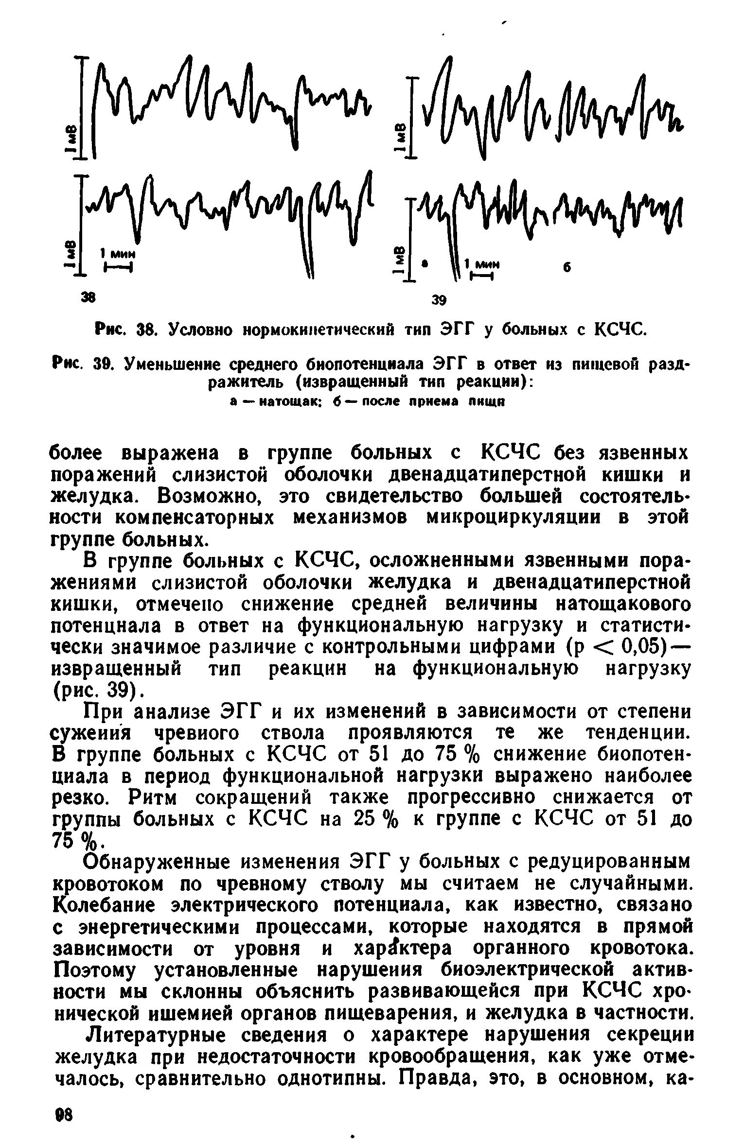 Рис. 39. Уменьшение среднего биопотенциала ЭГГ в ответ из пищевой раздражитель (извращенный тип реакции) ...