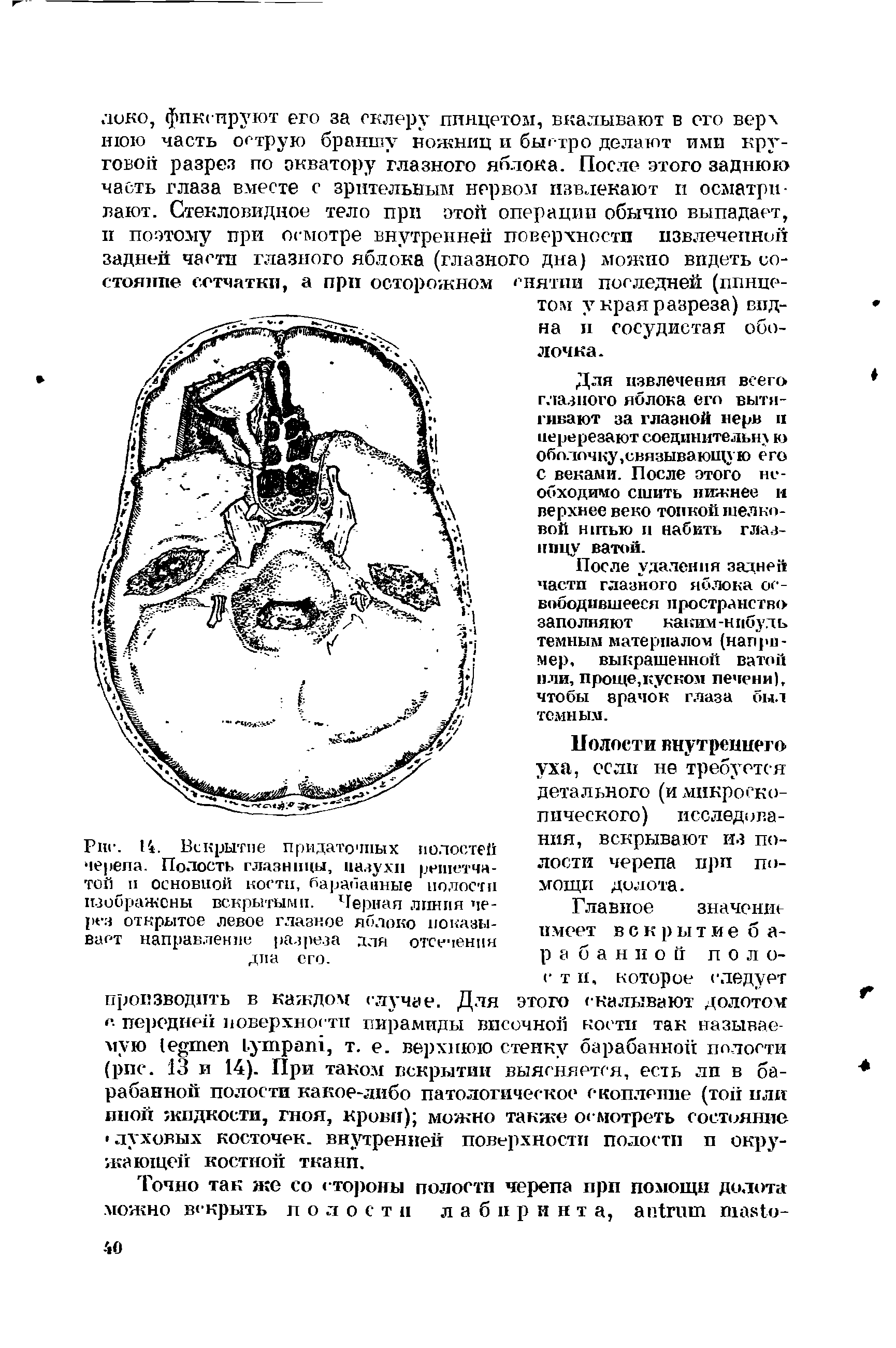 Рис. 14. Вскрытие придаточных черепа. Полость глазницы, пазухи той п основной кости, барабанные изображены вскрытыми. Черная линия через открытое левое глазное яблоко показывает направление разреза дна его.