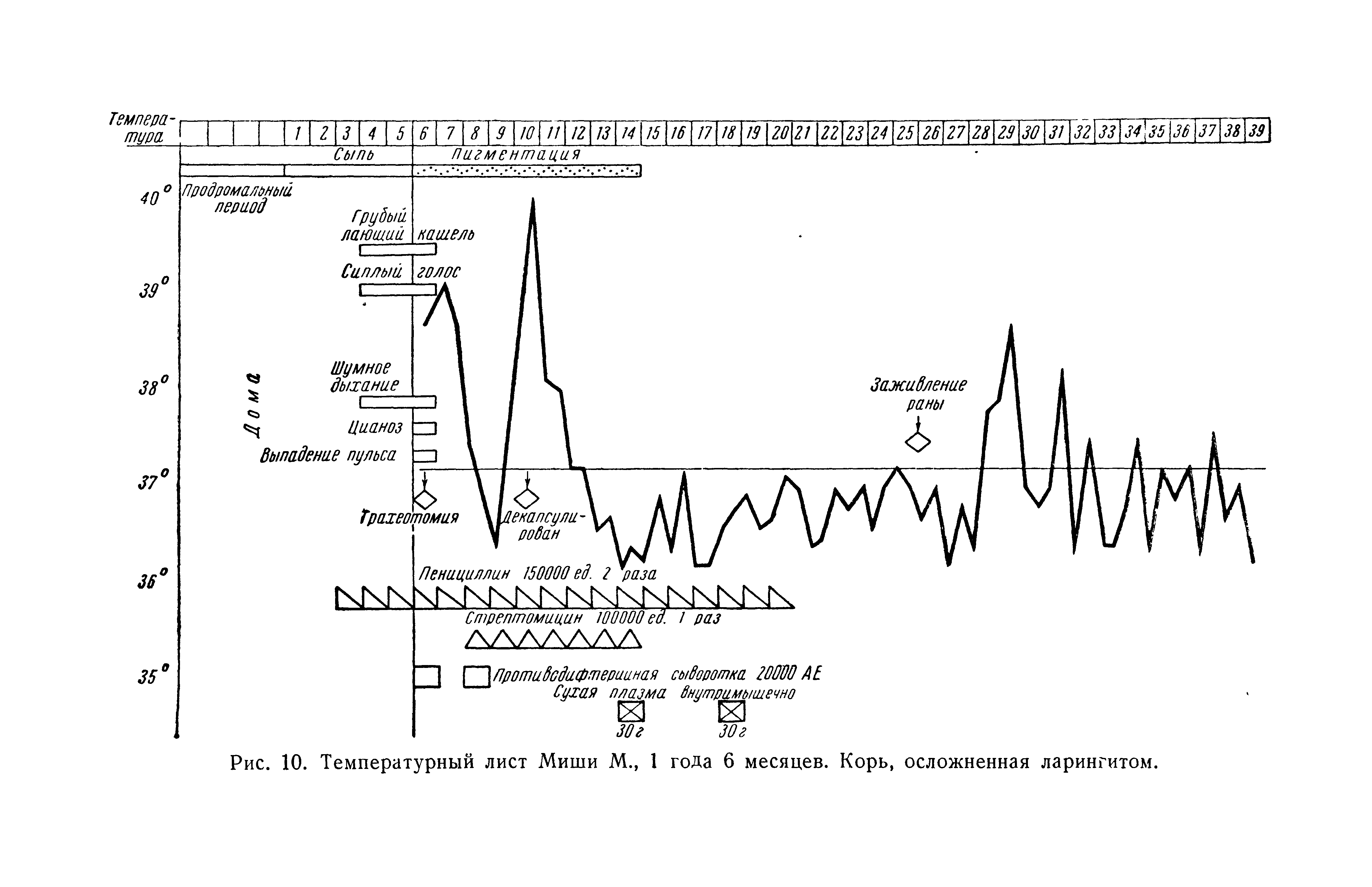 Рис. 10. Температурный лист Миши М., 1 года 6 месяцев. Корь, осложненная ларингитом.