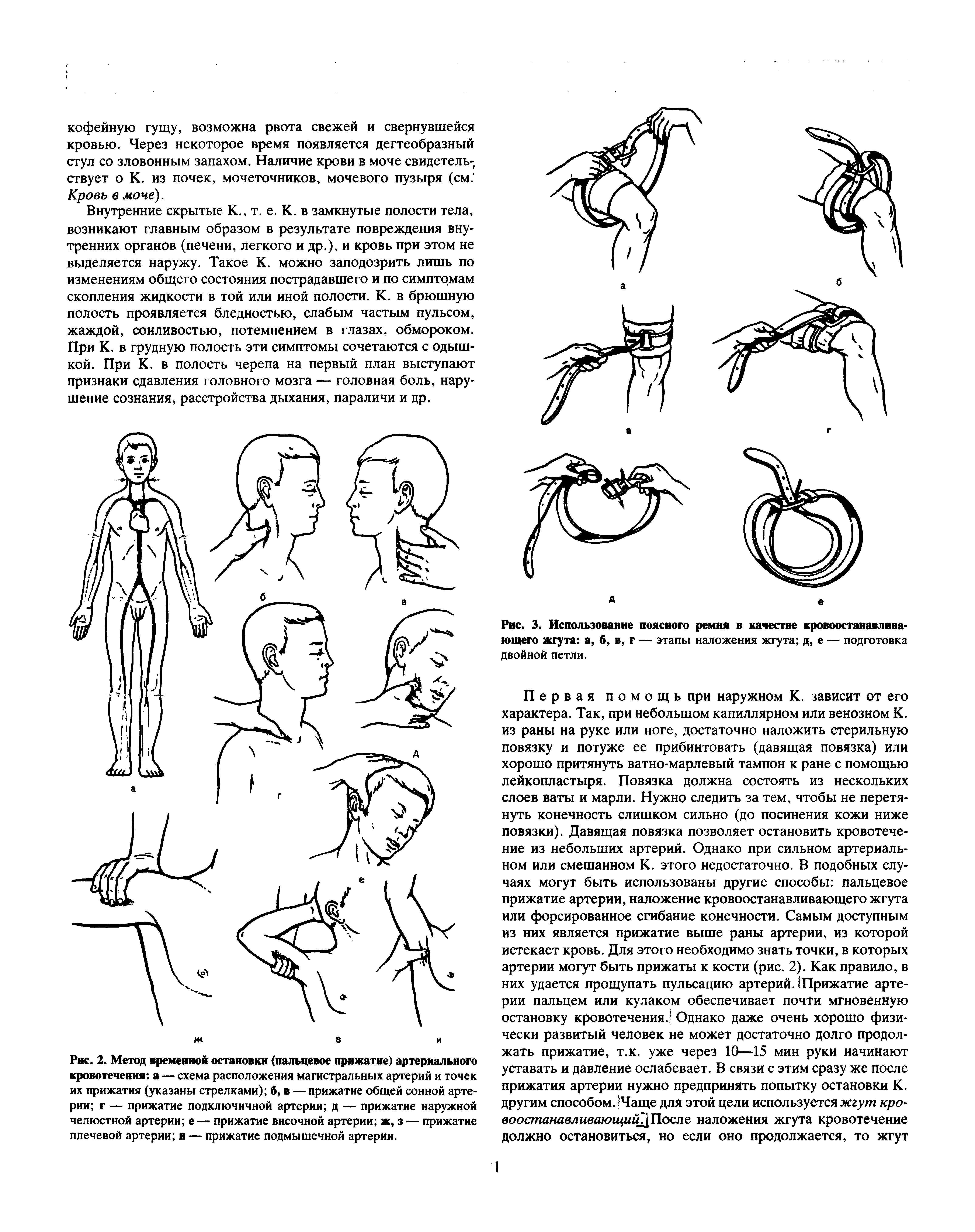 Рис. 2. Метод временной остановки (пальцевое прижатие) артериального кровотечения а — схема расположения магистральных артерий и точек их прижатия (указаны стрелками) б, в — прижатие общей сонной артерии г — прижатие подключичной артерии д — прижатие наружной челюстной артерии е — прижатие височной артерии ж, з — прижатие плечевой артерии и — прижатие подмышечной артерии.