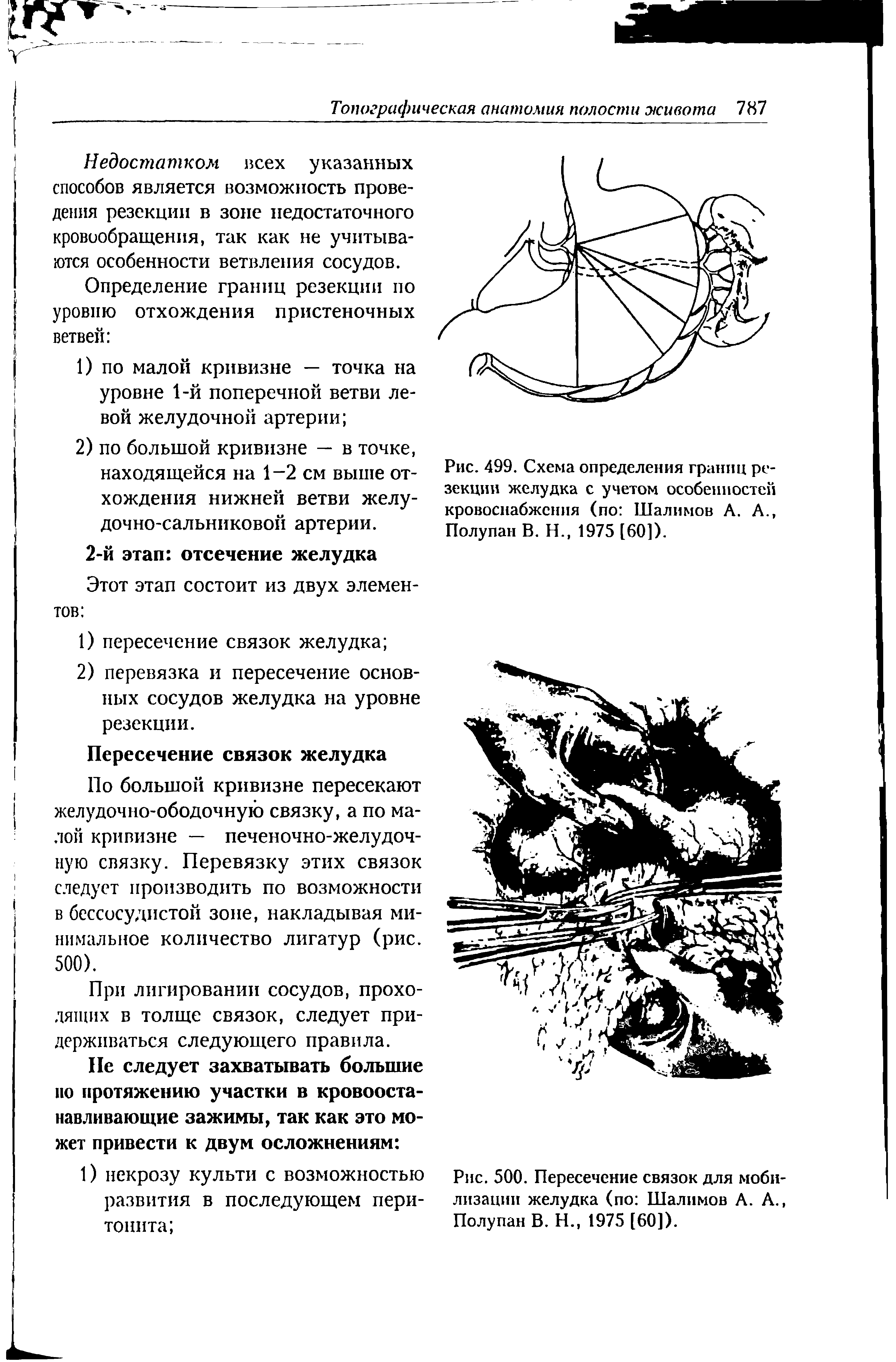 Рис. 500. Пересечение связок для мобилизации желудка (по Шалимов А. А., Полупан В. Н., 1975 [60]).