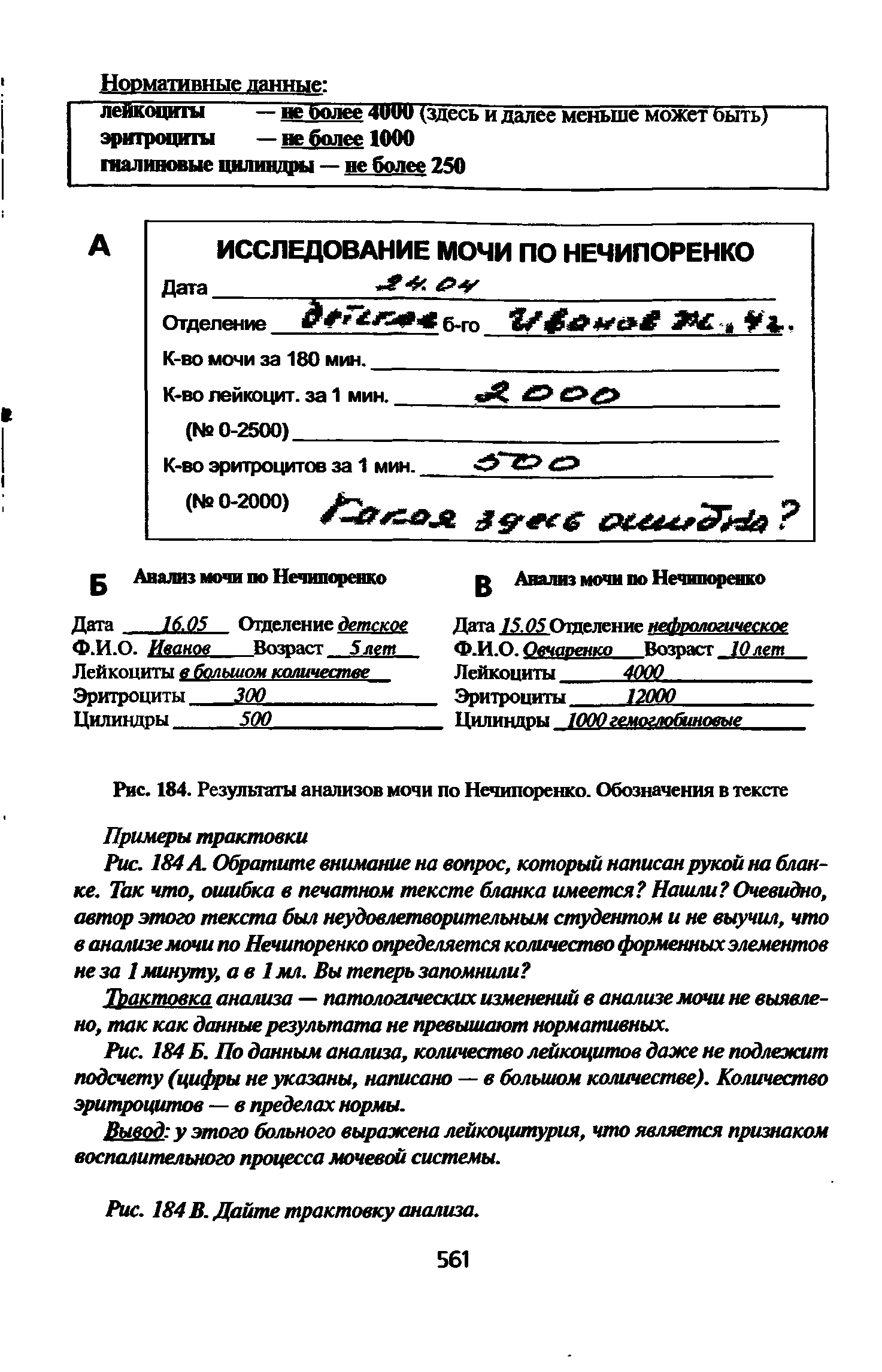 Рис. 184 А. Обратите внимание на вопрос, который написан рукой на бланке. Так что, ошибка в печатном тексте бланка имеется Нашли Очевидно, автор этого текста был неудовлетворительным студентом и не выучил, что в анализе мочи по Нечипоренко определяется количество форменных элементов не за I минуту, а в 1 мл. Вы теперь запомнили ...