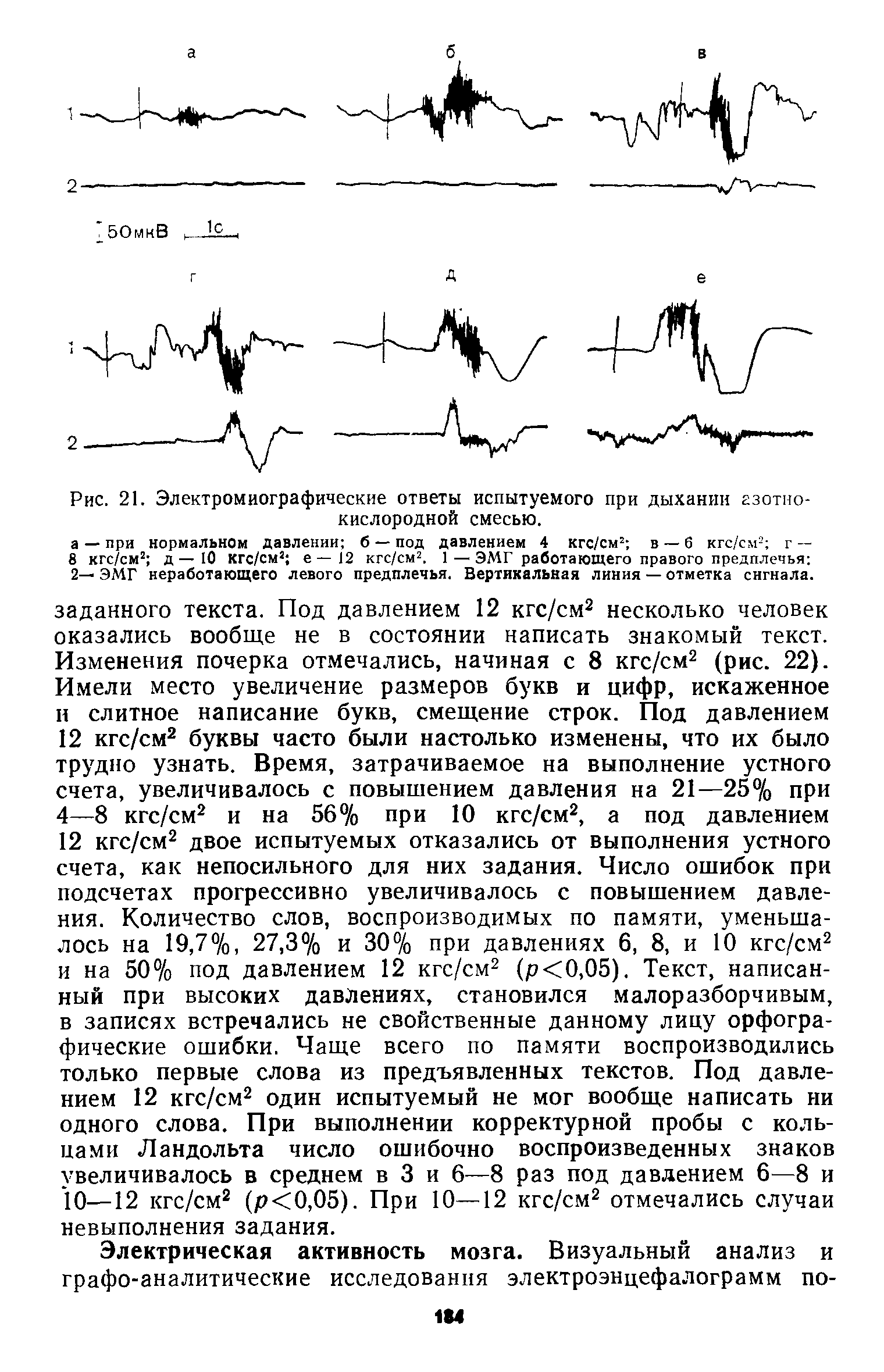 Рис. 21. Электромиографические ответы испытуемого при дыхании азотнокислородной смесью.