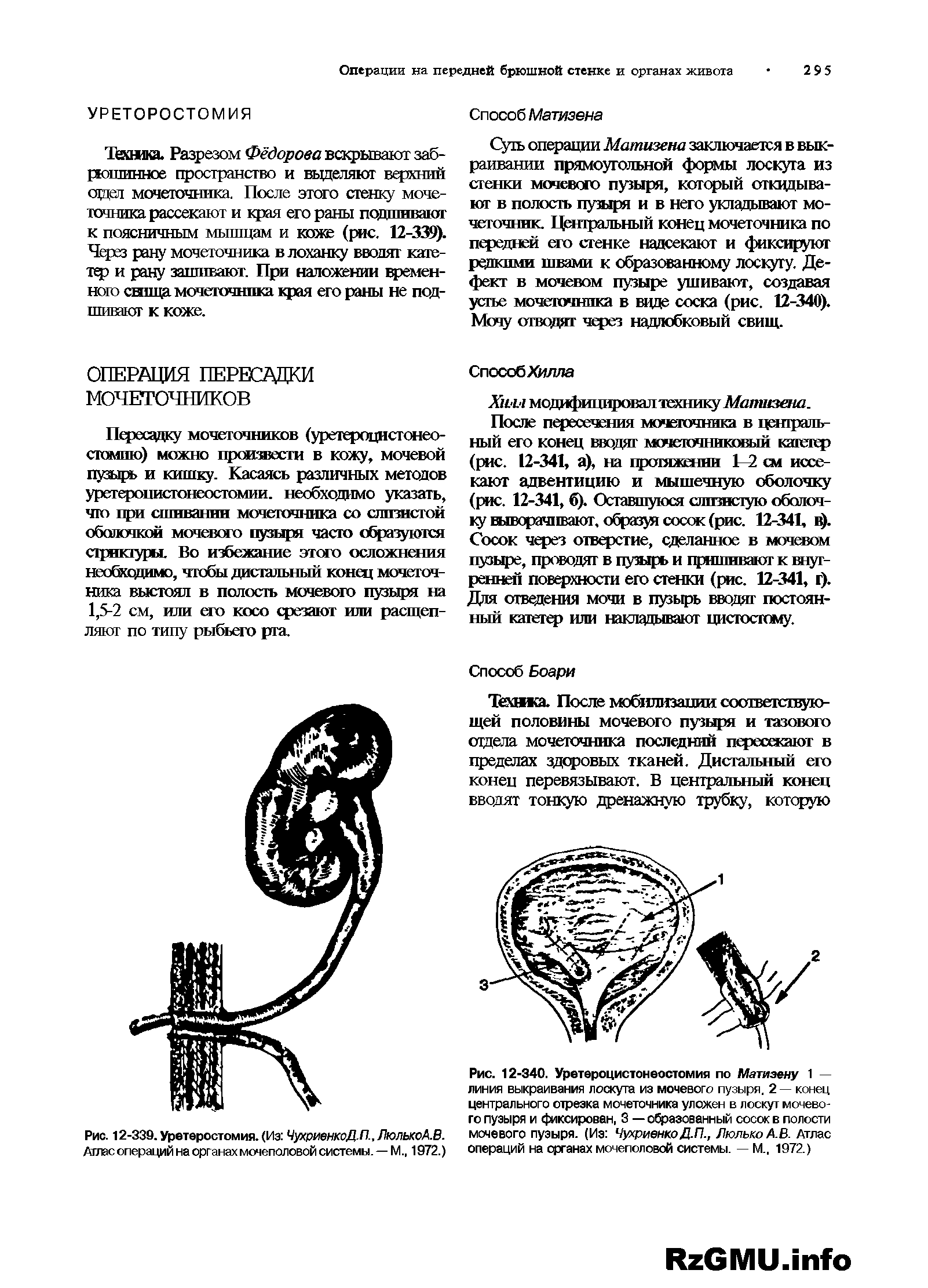 Рис. 12-340. Уретероцистонеостомия по Матизену 1 — линия выкраивания лоскута из мочевого пузыря. 2— конец центрального отрезка мочеточника уложен в лоскут мочевого пузыря и фиксирован, 3 — образованный сосок в полости мочевого пузыря. (Из ЧухриенкоДЛ., ЛюлькоА.В. Атлас операций на органах мочеполовой системы. — М., 1972.)...