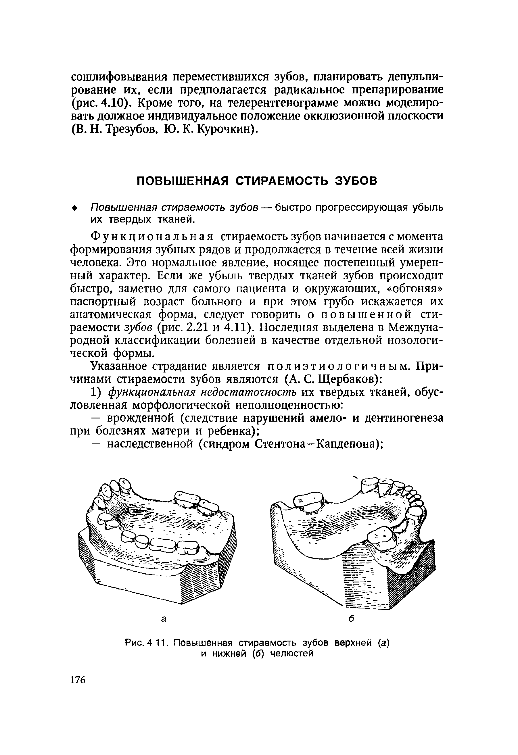 Рис. 4 11. Повышенная стираемость зубов верхней (а) и нижней (б) челюстей...