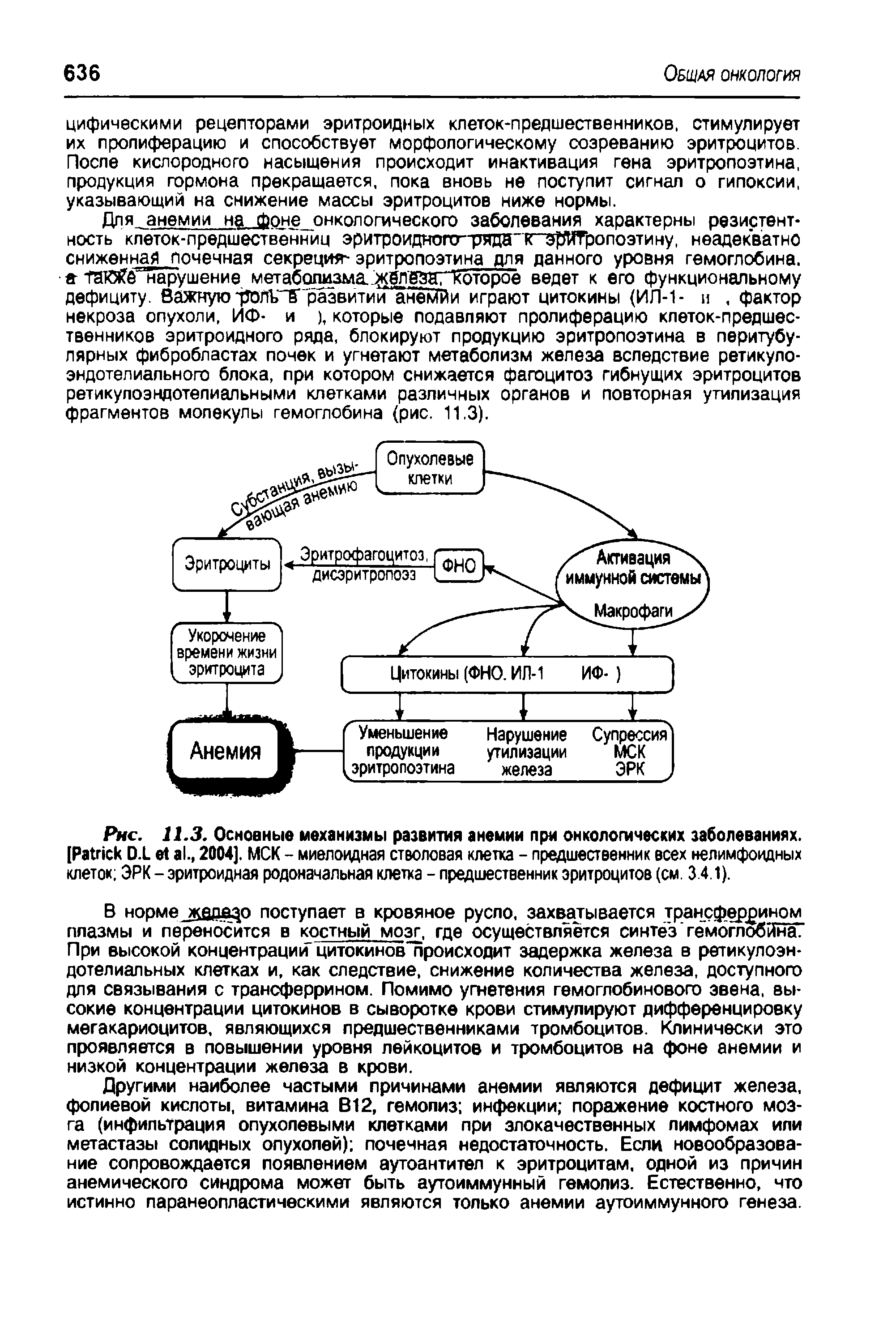 Рис. 11.3. Основные механизмы развития анемии при онкологических заболеваниях. [P D.L ., 2004]. MCK - миелоидная стволовая клетка - предшественник всех нелимфоидных клеток ЭРК - эритроидная родоначальная клетка - предшественник эритроцитов (см. 3.4.1).
