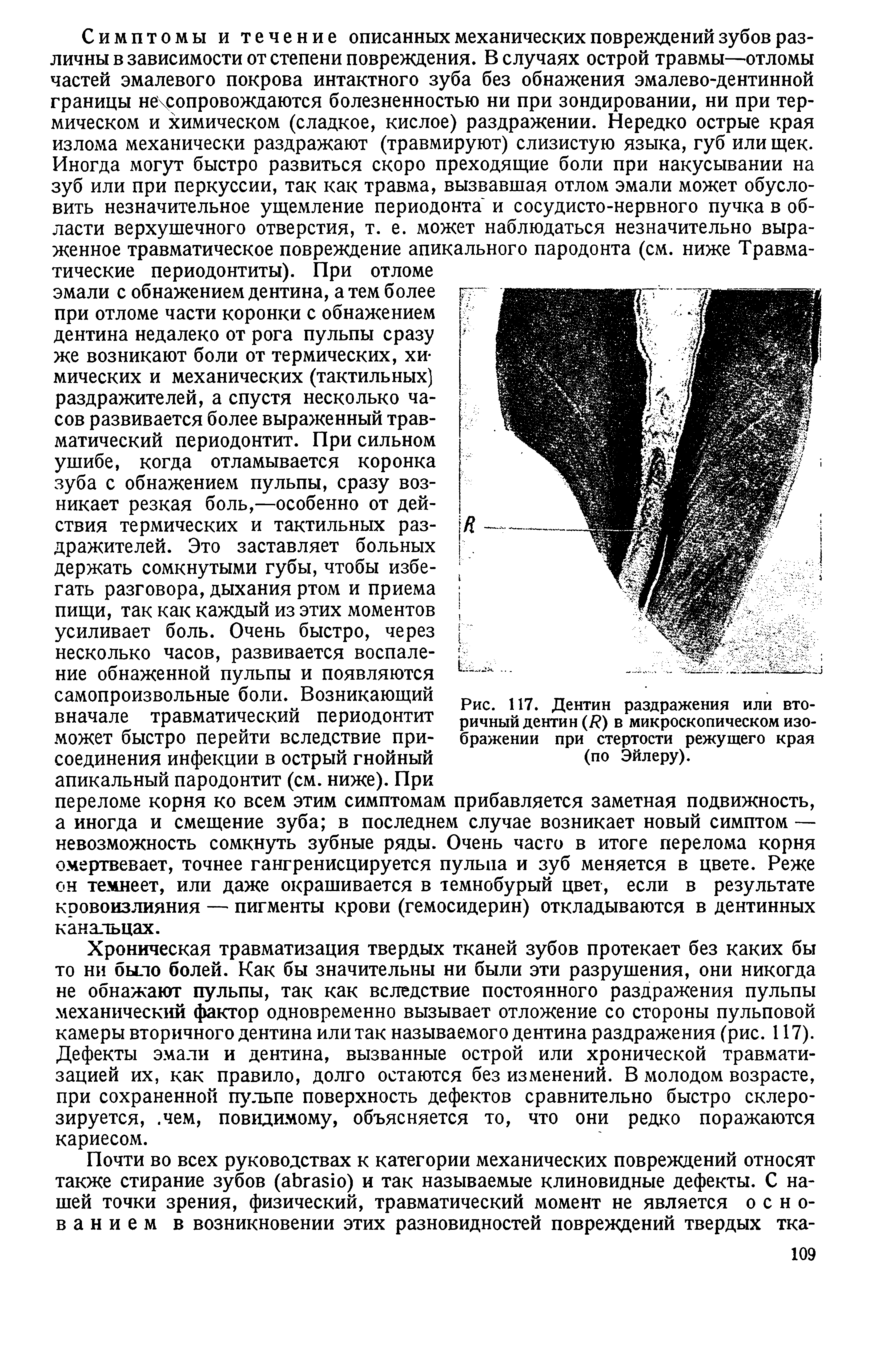 Рис. 117. Дентин раздражения или вторичный дентин (/ ) в микроскопическом изображении при стертости режущего края (по Эйлеру).