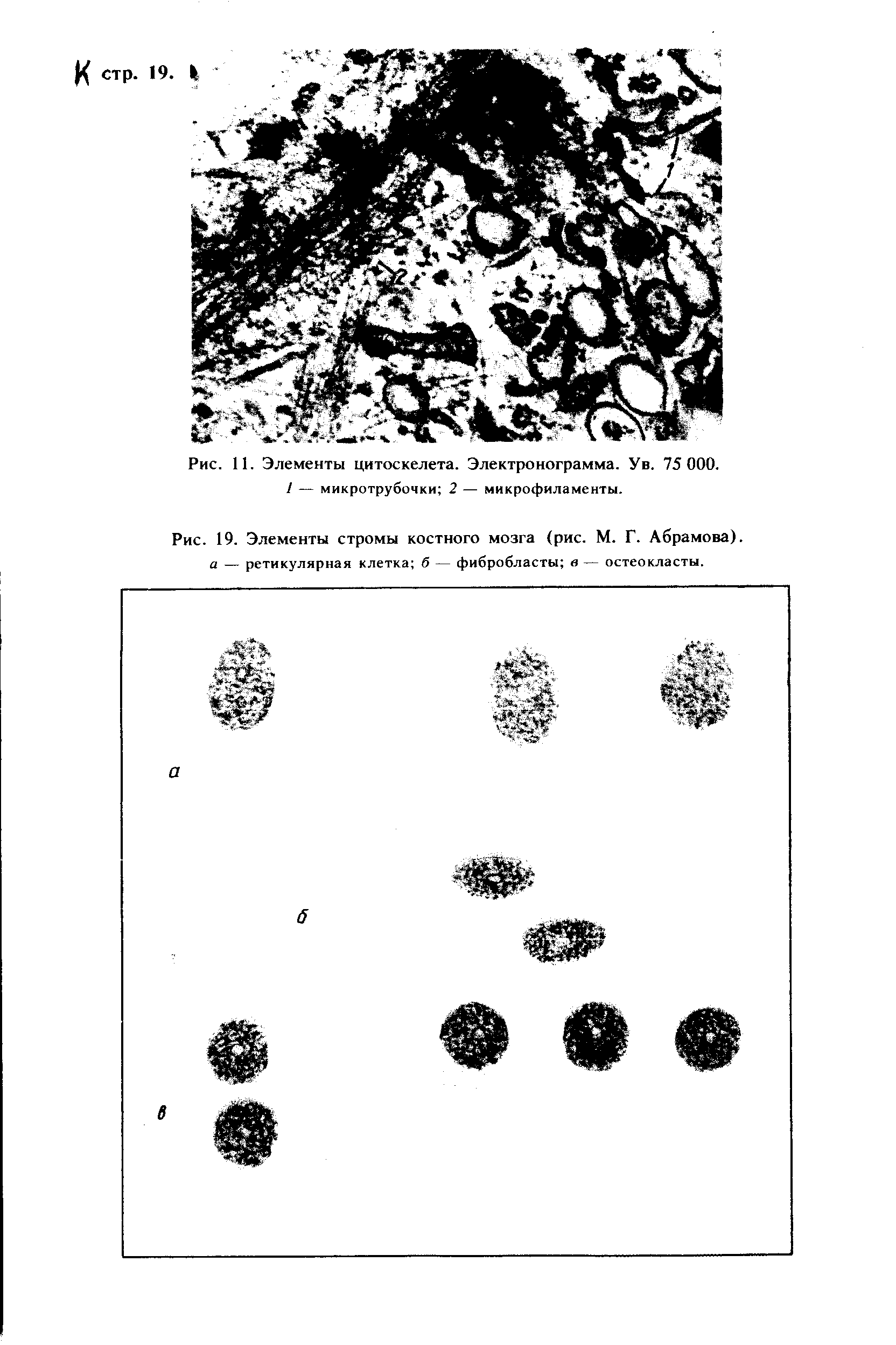 Рис. 19. Элементы стромы костного мозга (рис. М. Г. Абрамова). а — ретикулярная клетка б — фибробласты в — остеокласты.