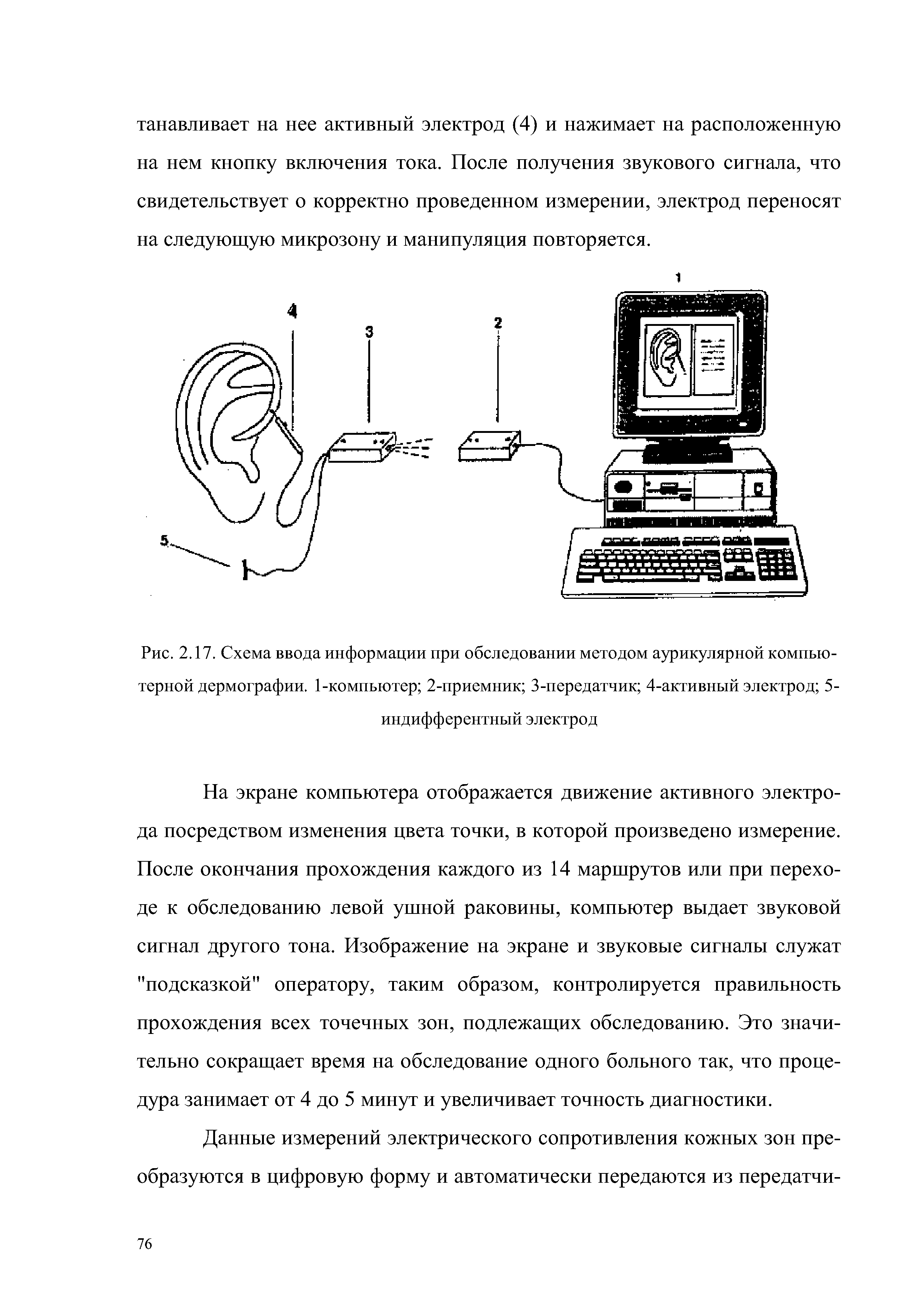 Рис. 2.17. Схема ввода информации при обследовании методом аурикулярной компьютерной дермографии. 1-компьютер 2-приемник 3-передатчик 4-активный электрод 5-индифферентный электрод...