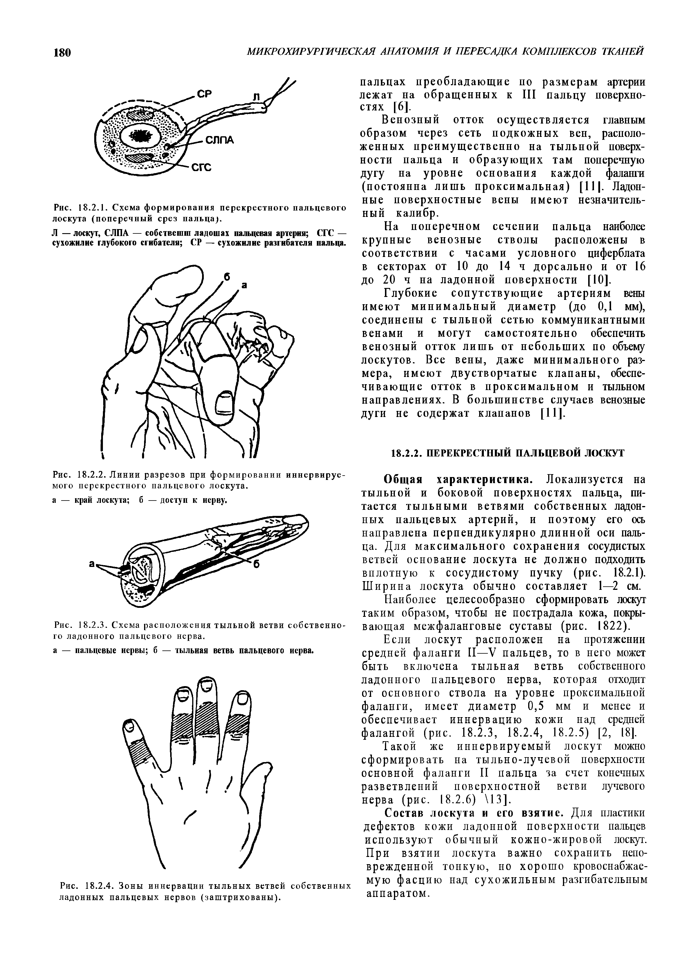Рис. 18.2.1. Схема формирования перекрестного пальцевого лоскута (поперечный срез пальца).