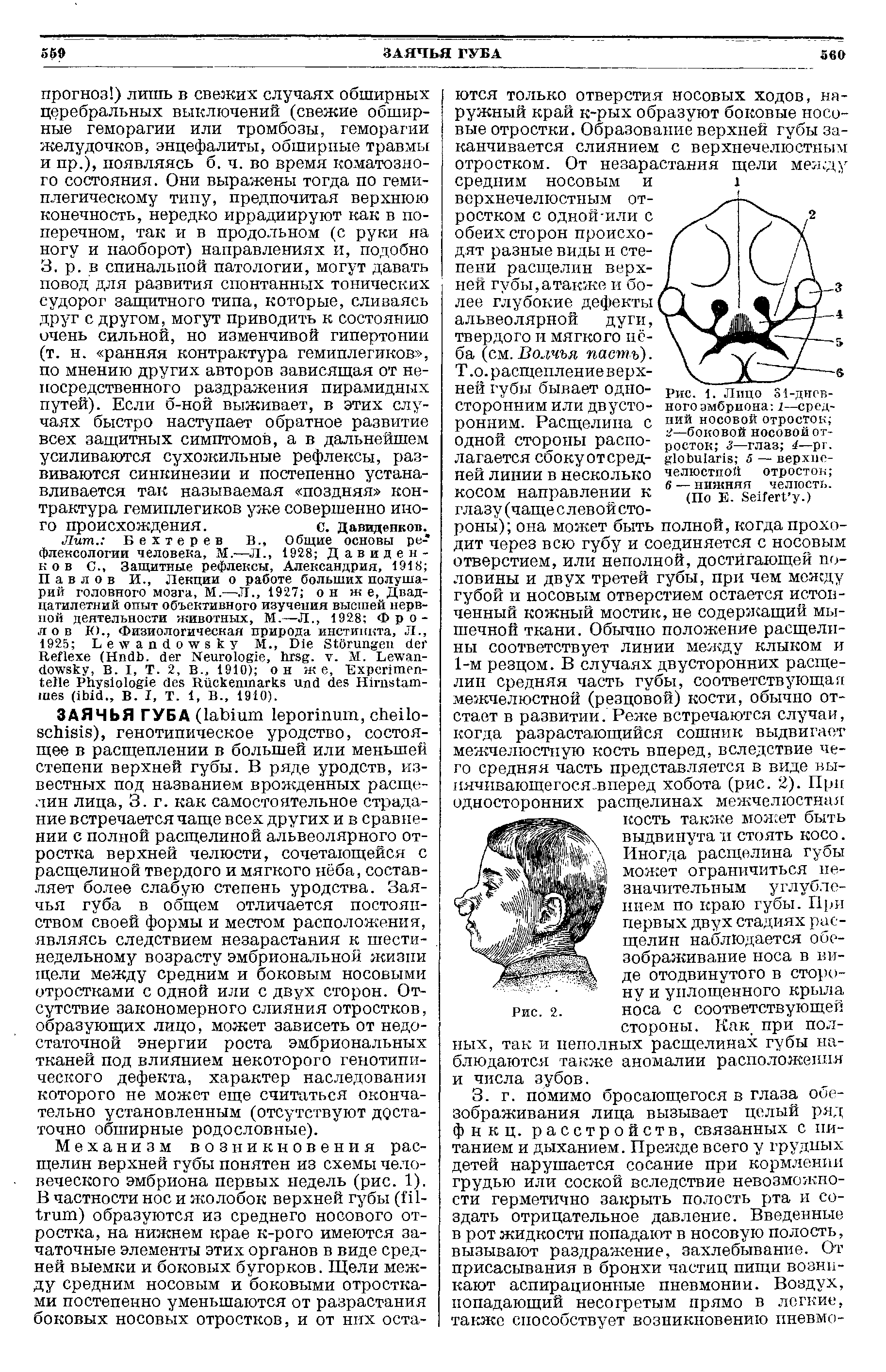 Рис. 1. Лицо 81-дневного эмбриона 1—средний носовой отросток 2—боковой носовой отросток 3—глаз 4—рг. 1оЬи1ап8 5 — верхнечелюстной отросток 6 — нижняя челюсть.