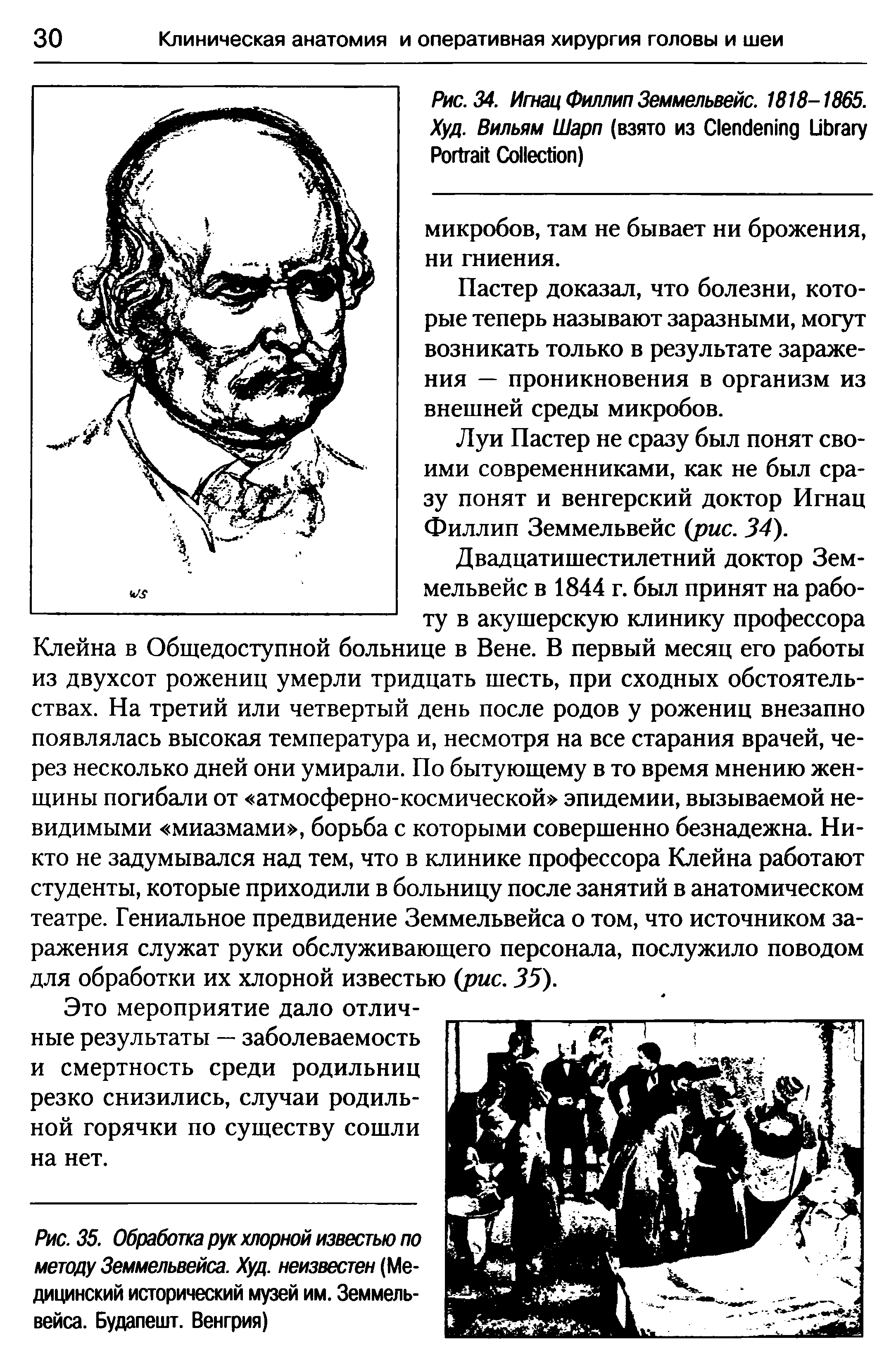 Рис. 35. Обработка рук хлорной известью по методу Земмельвейса. Худ. неизвестен (Медицинский исторический музей им. Земмельвейса. Будапешт. Венгрия)...